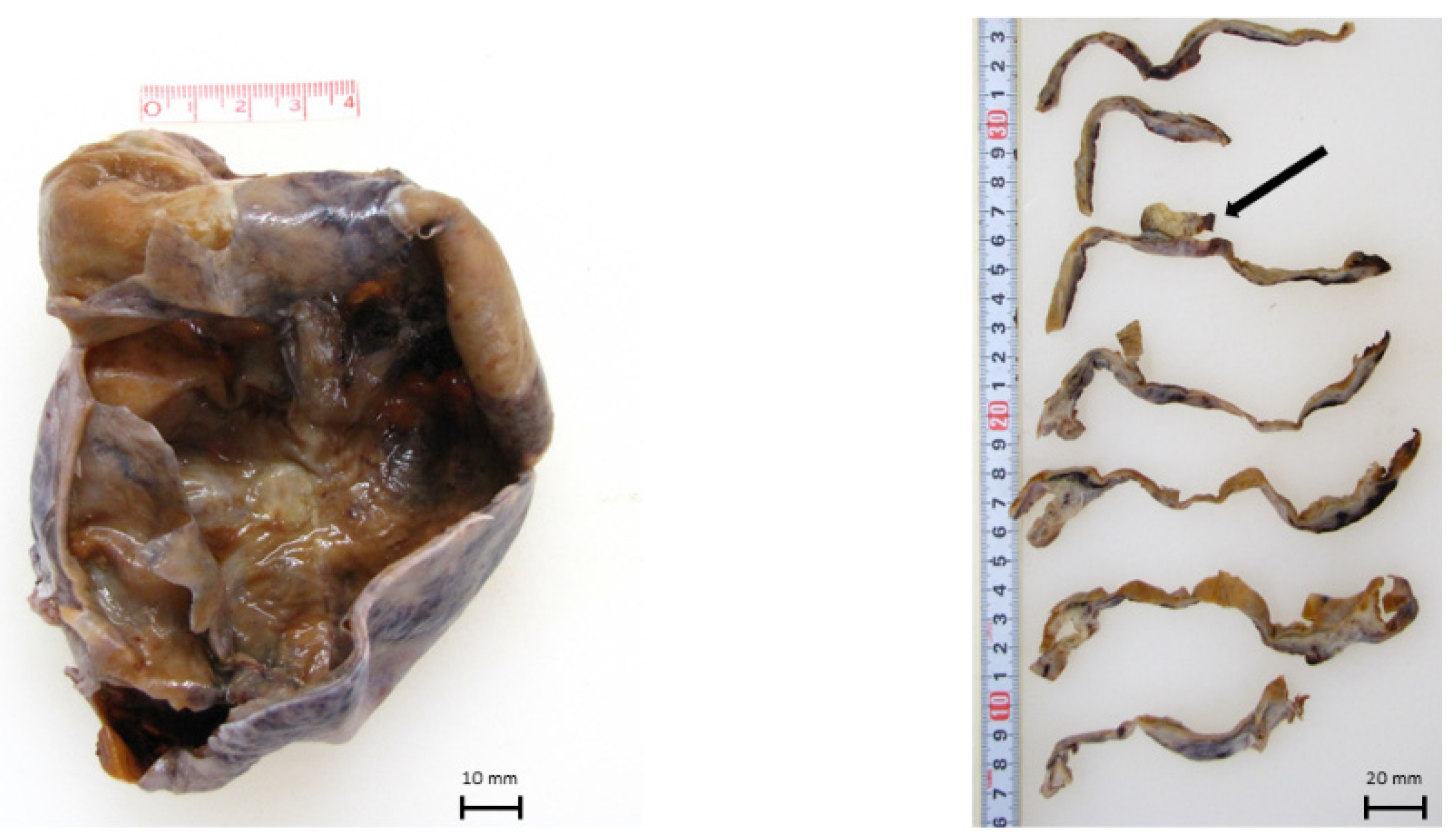 Ijms 22 02436 g001 Ijms 22 02436 g001