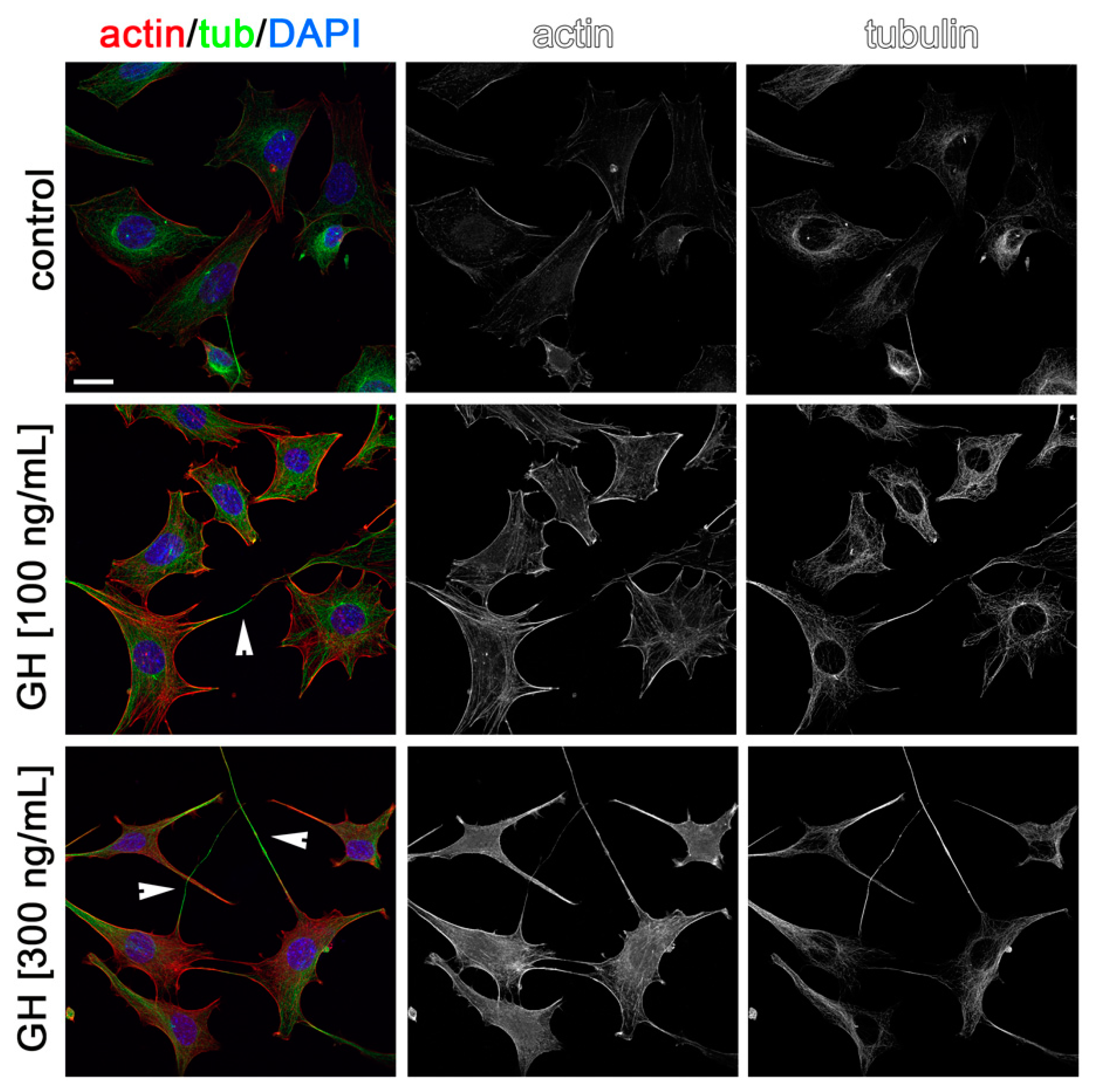 Ijms 22 02445 g006 Ijms 22 02445 g006