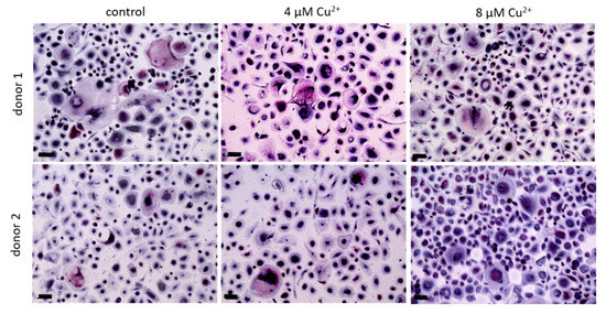 Ijms 22 02451 g007 550