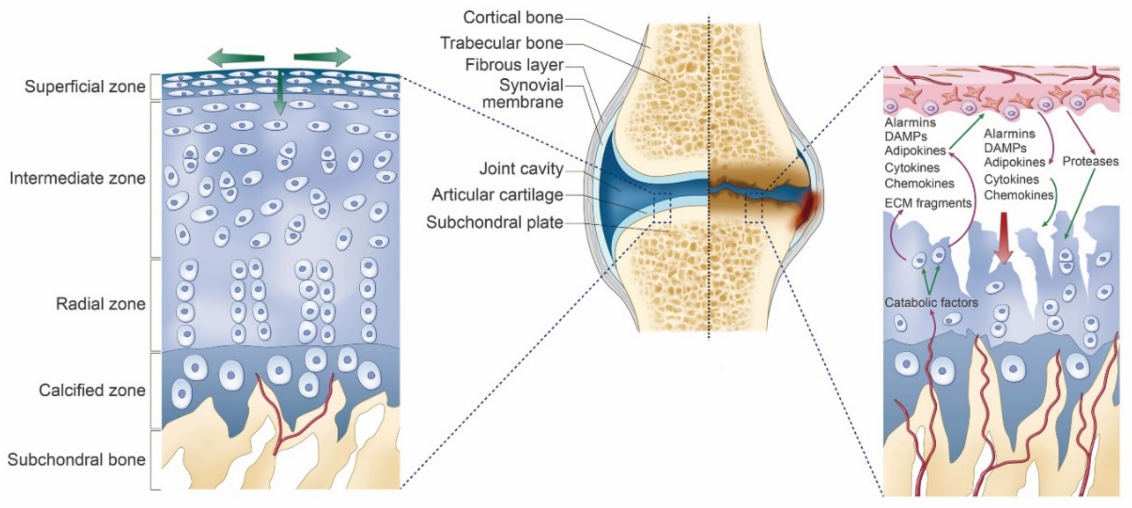 Fájdalom pr osteoarthritis fórum