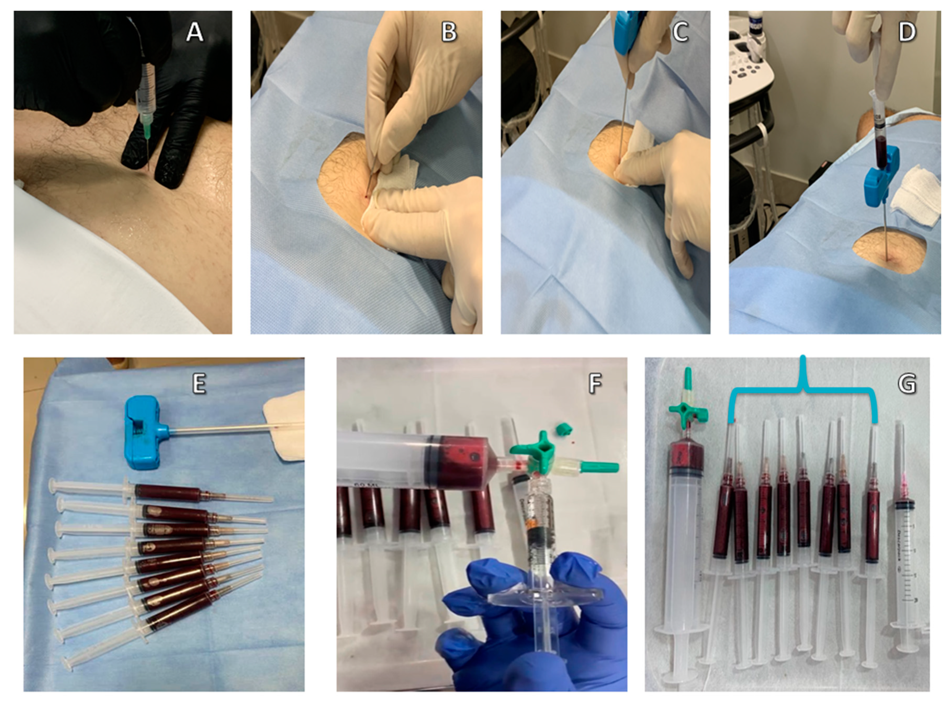 Ijms 22 02762 g002 Ijms 22 02762 g002