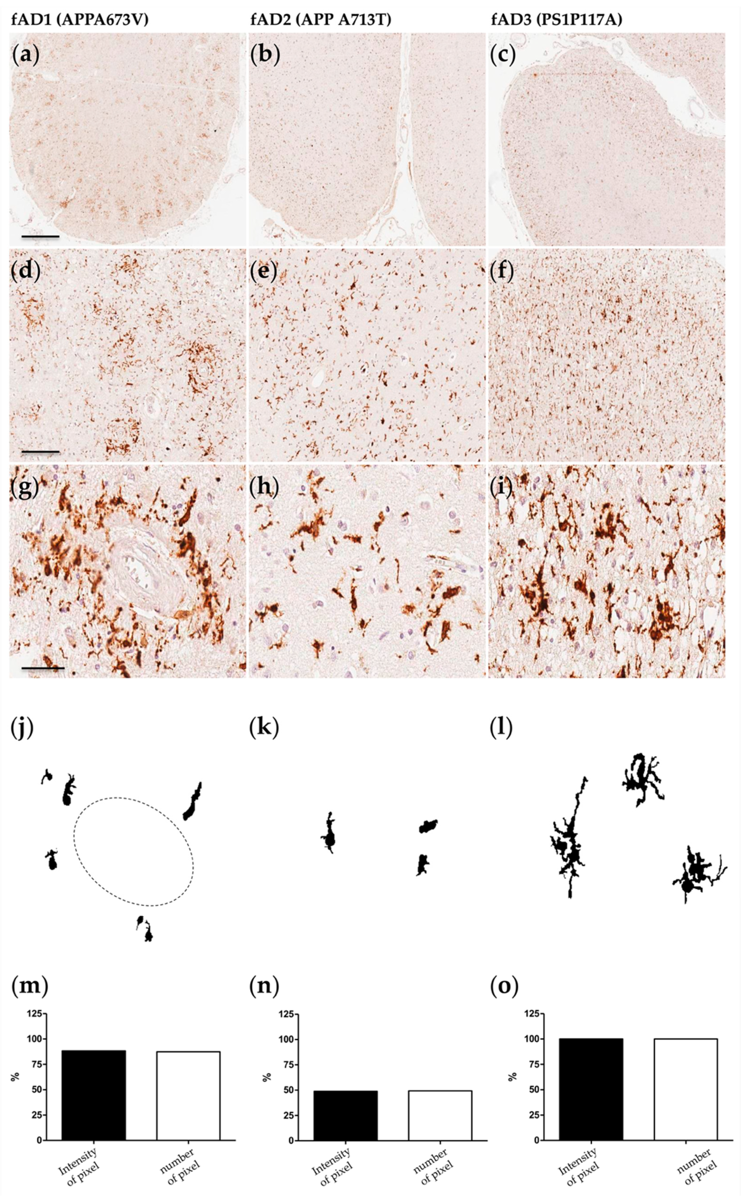 Ijms Free Full Text Microglial Heterogeneity And Its Potential Role In Driving Phenotypic Diversity Of Alzheimer S Disease Html