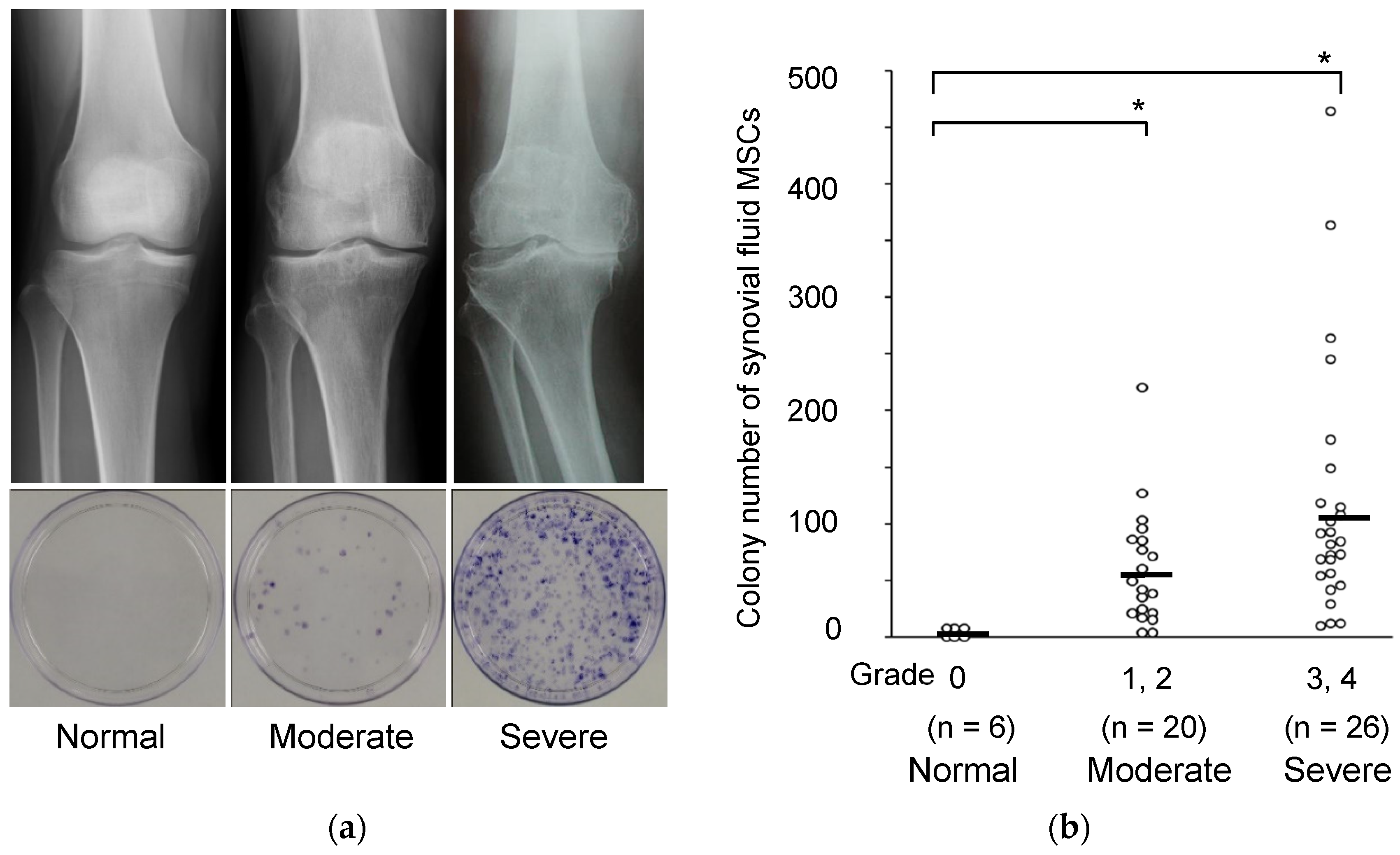 Synovial Membrane Knee