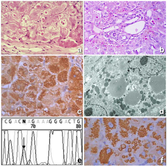 IJMS | Free Full-Text | The Discovery of Endoplasmic Reticulum Storage