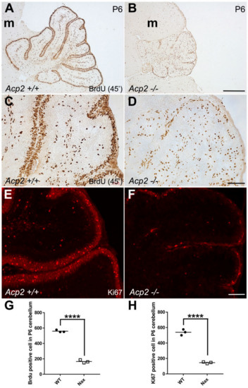 Reduced Granule Cell Proliferation and Molecular Dysregulation in