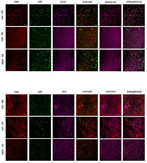 Distinct Regulation of Dopamine D3 Receptor in the Basolateral