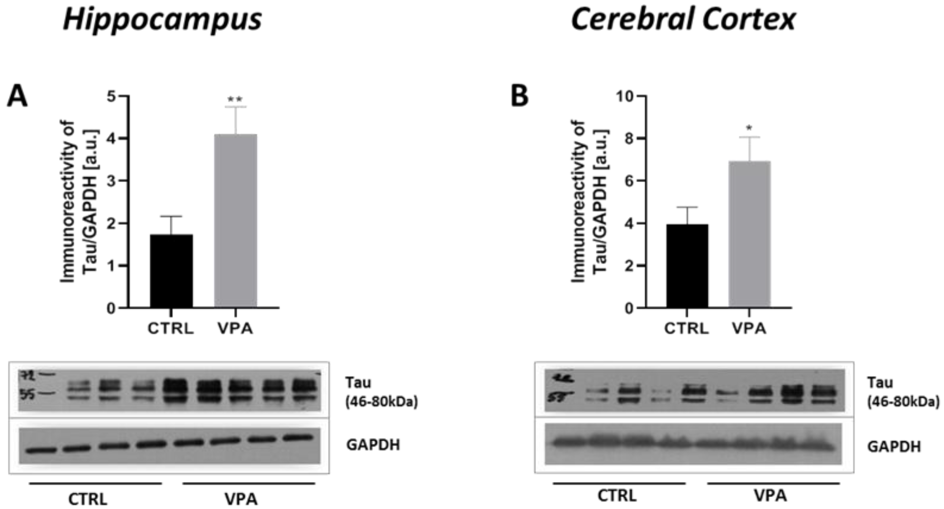 Ijms 22 03209 g002 Ijms 22 03209 g002