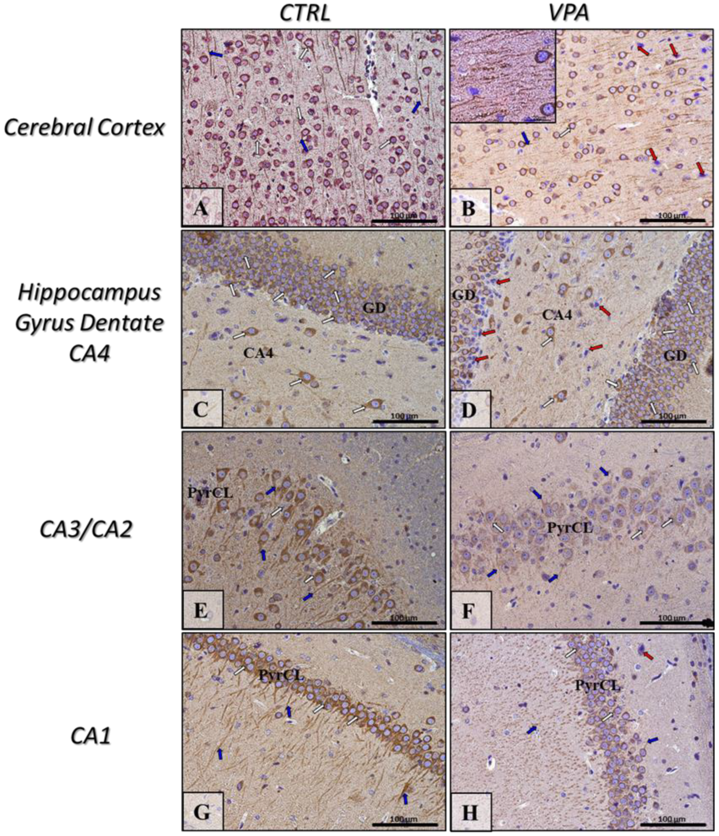 Ijms 22 03209 g003 Ijms 22 03209 g003