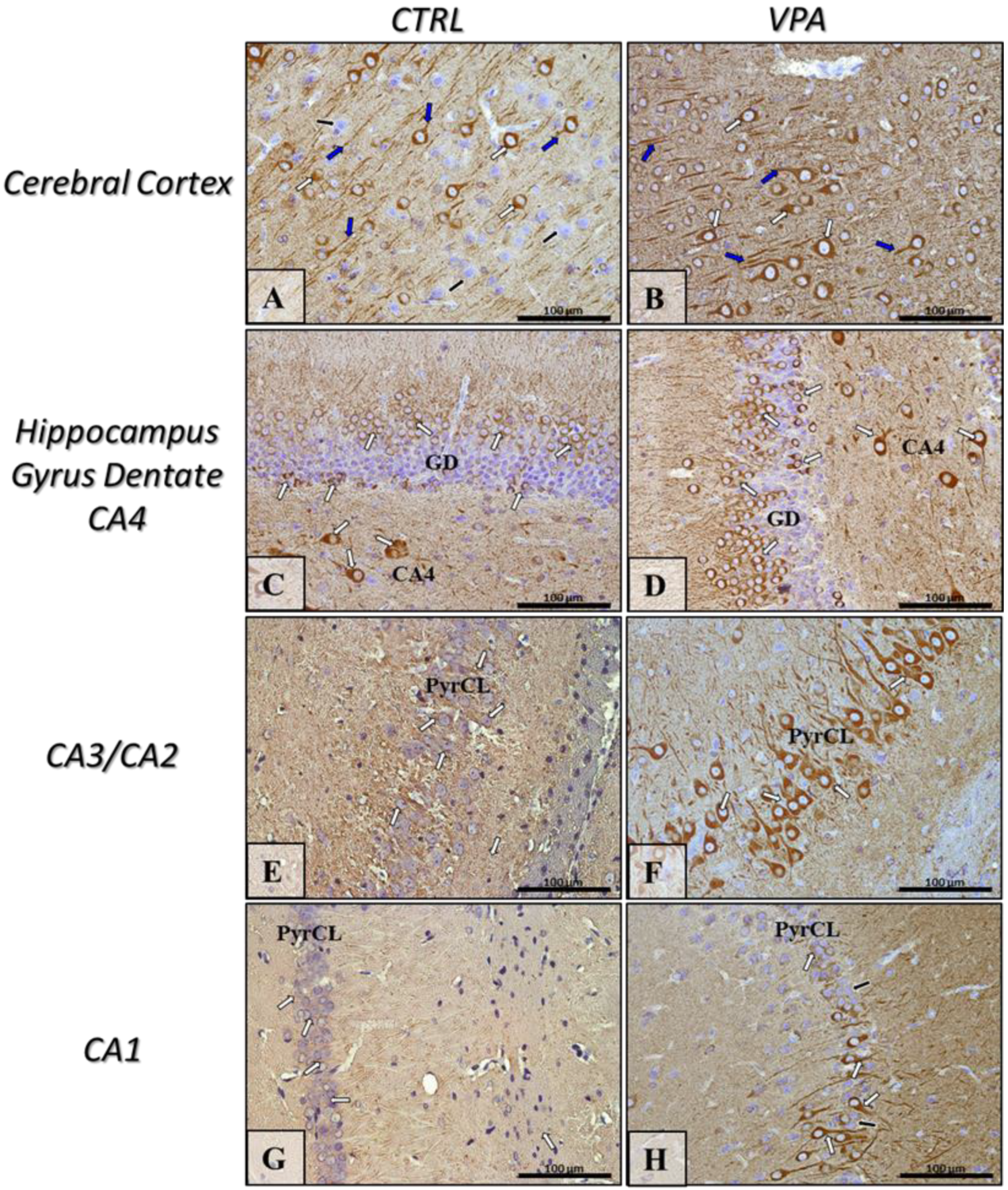 Ijms 22 03209 g004 Ijms 22 03209 g004