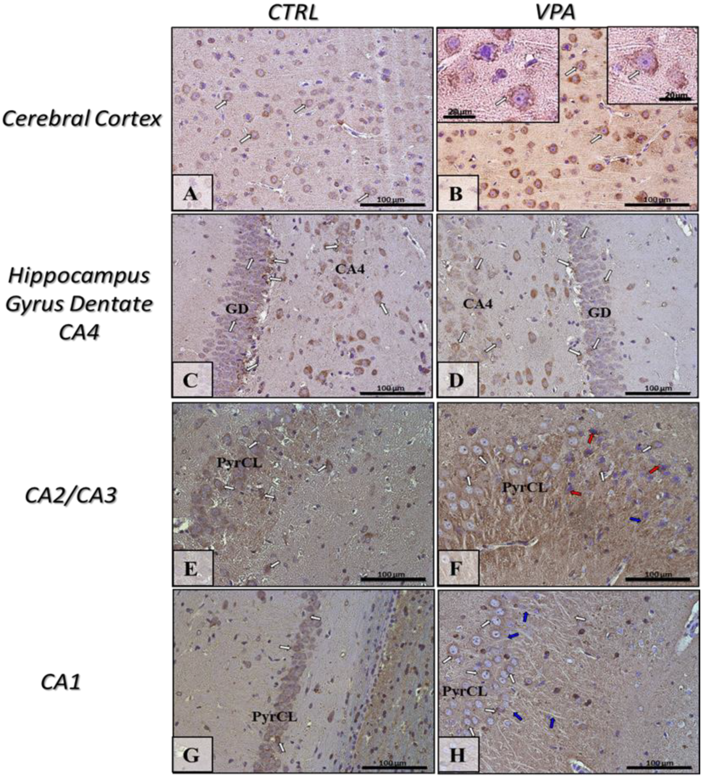 Ijms 22 03209 g006 Ijms 22 03209 g006