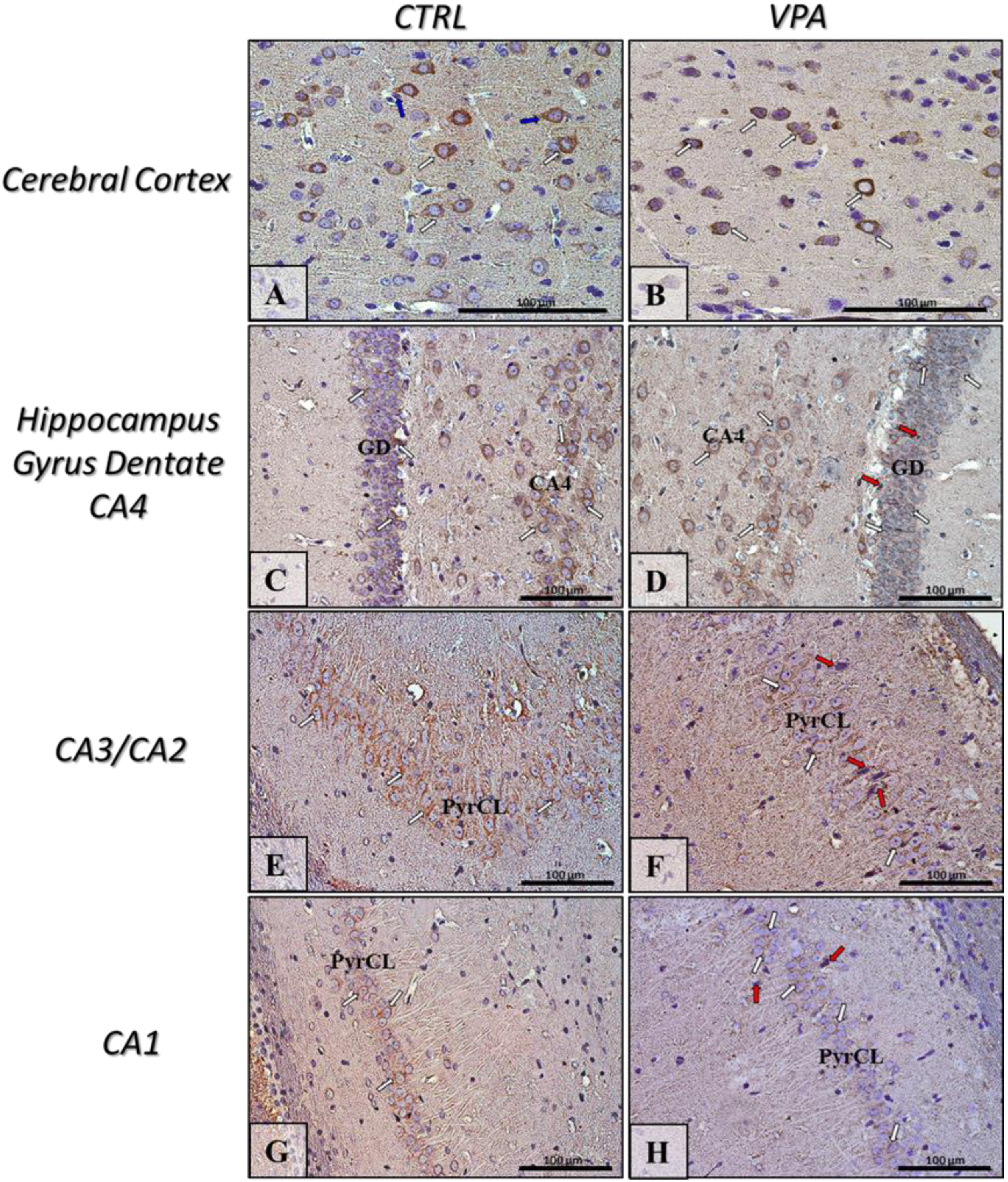 Ijms 22 03209 g007 Ijms 22 03209 g007