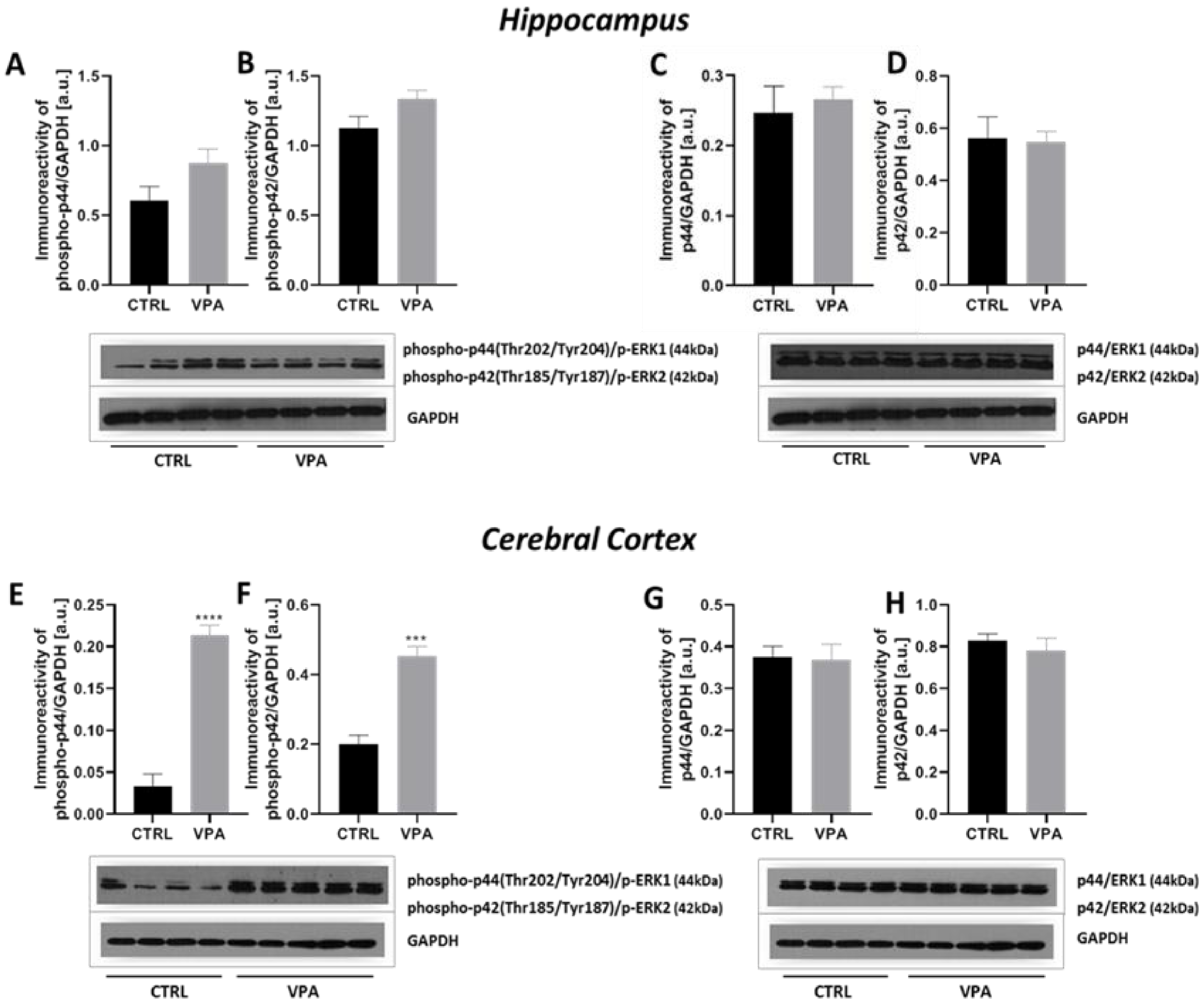 Ijms 22 03209 g011 Ijms 22 03209 g011