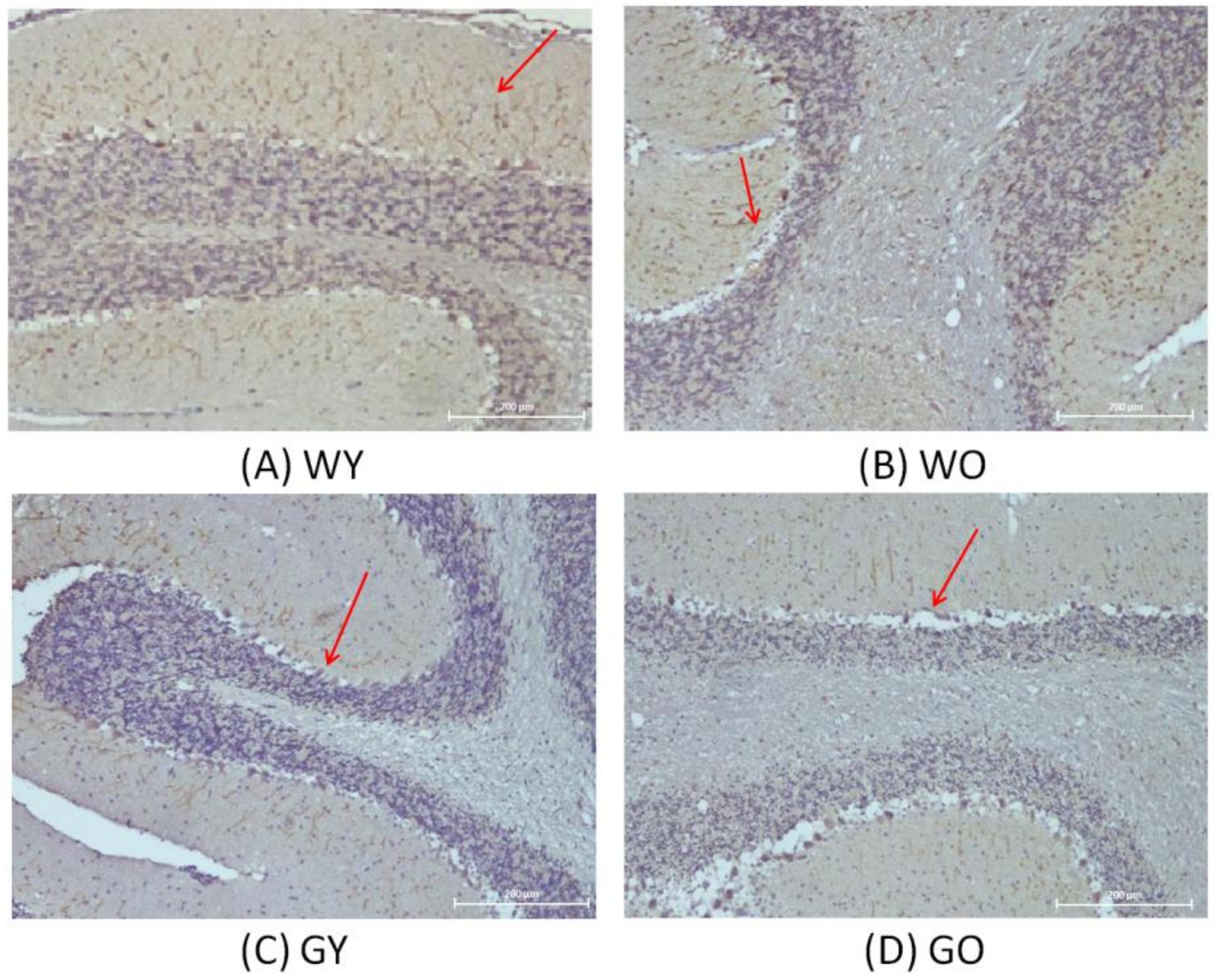 Ijms 22 03278 g004 Ijms 22 03278 g004