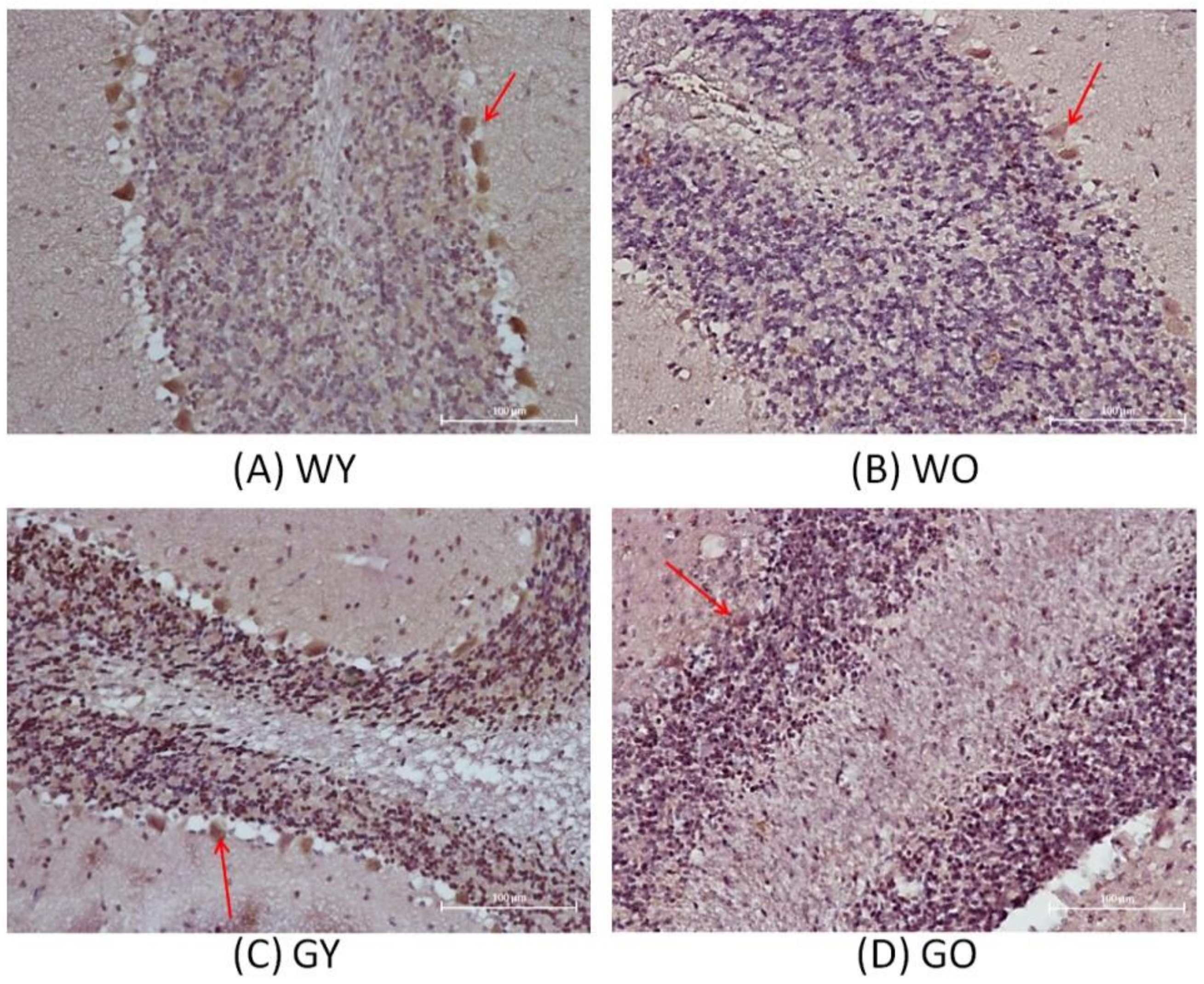 Ijms 22 03278 g006 Ijms 22 03278 g006