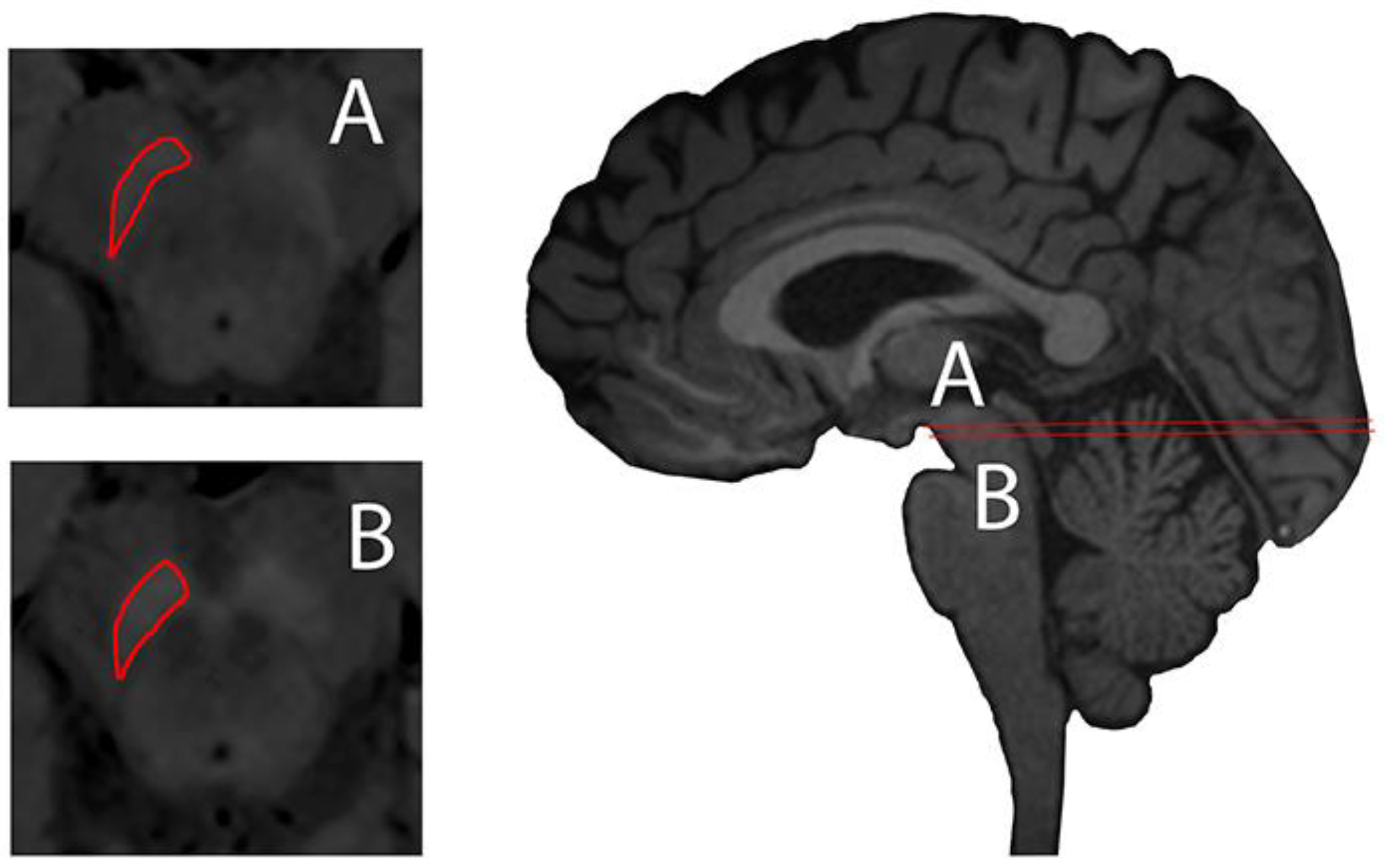 Ijms 22 03338 g002