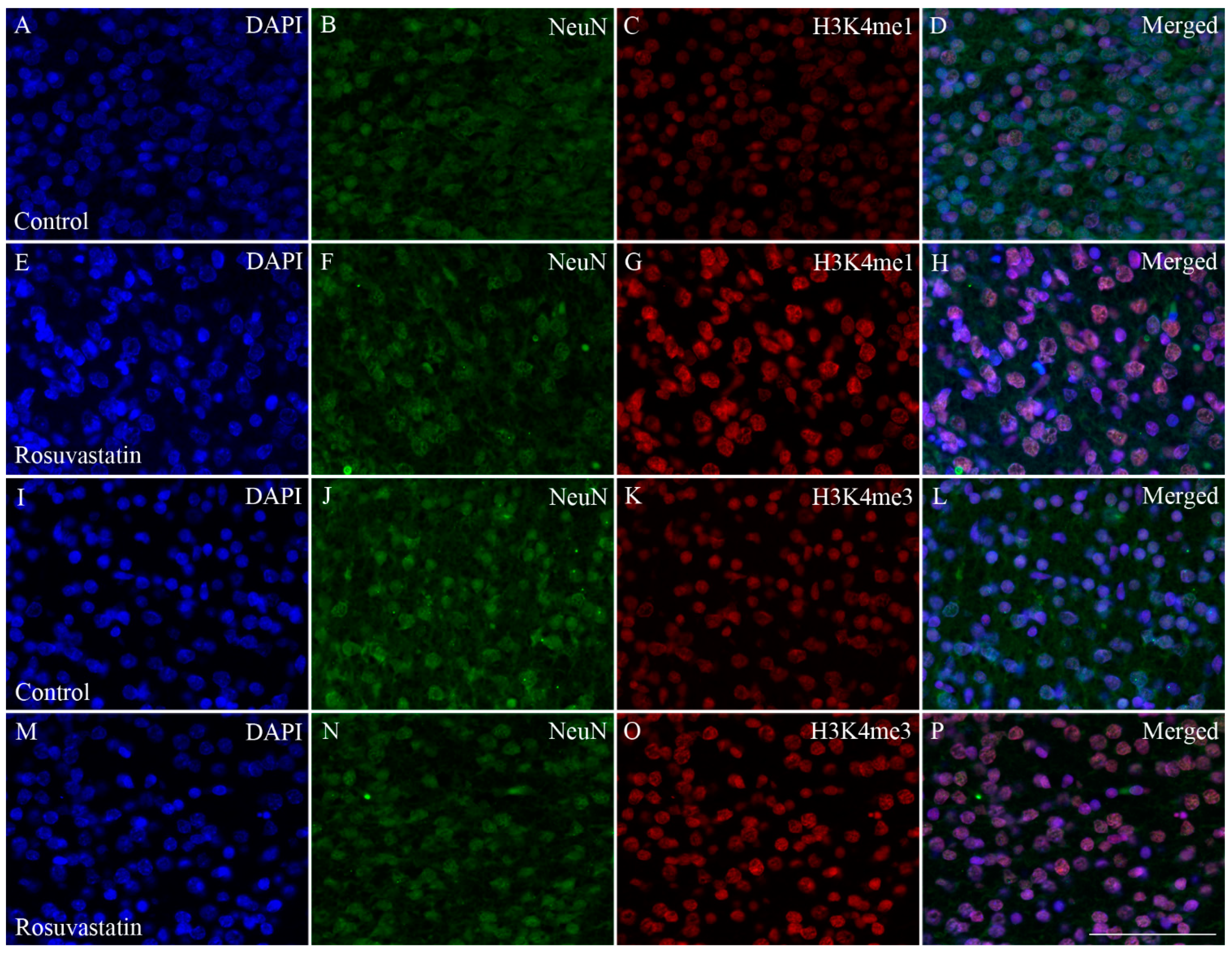 Ijms Free Full Text Epigenetic Consequences Of In Utero Exposure To Rosuvastatin Alteration Of Histone Methylation Patterns In Newborn Rat Brains Html Ijms Free Full Text Epigenetic Consequences Of In Utero Exposure To Rosuvastatin Alteration Of Histone Methylation Patterns In Newborn Rat Brains Html