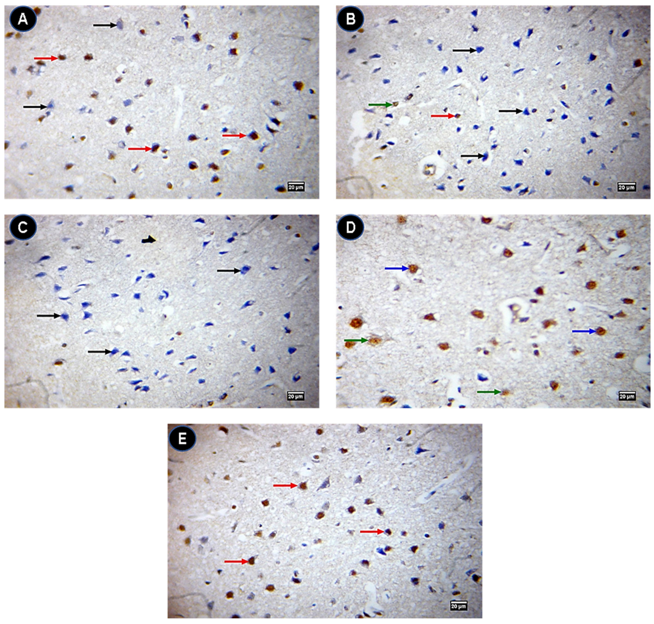 Ijms 22 03829 g009 Ijms 22 03829 g009