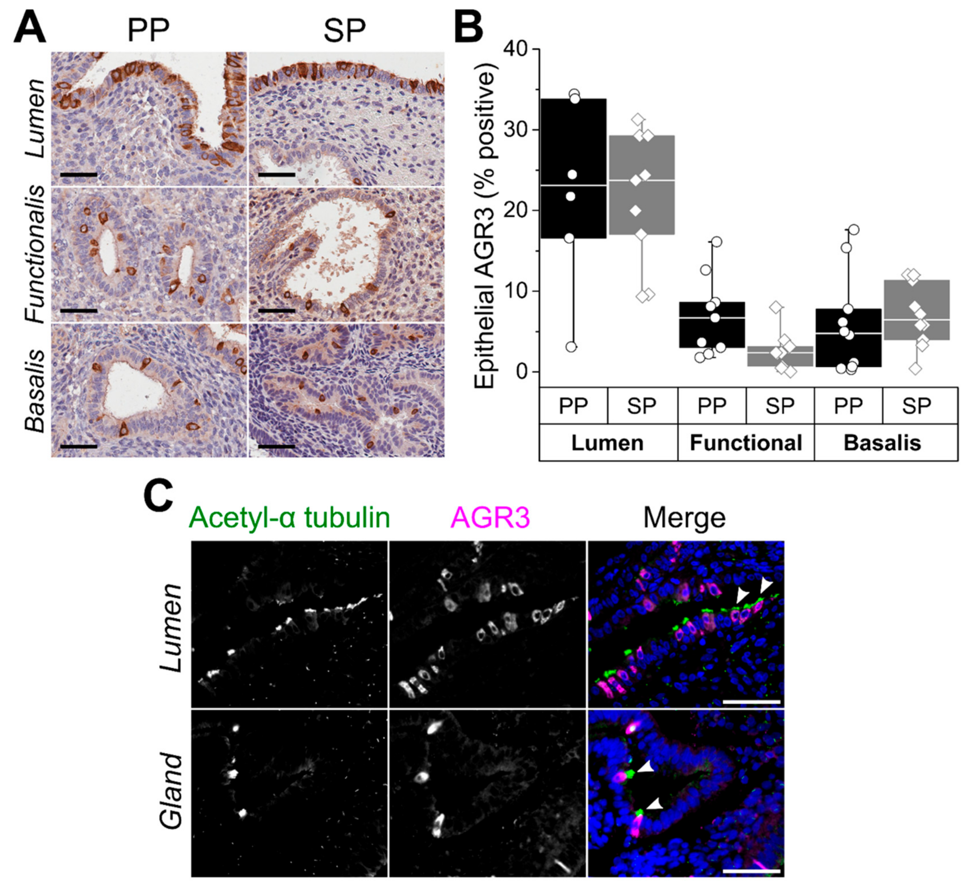 Ijms Free Full Text Anterior Gradient Protein 3 And S100 Calcium Binding Protein P Levels In Different Endometrial Epithelial Compartments May Play An Important Role In Recurrent Pregnancy Failure Html