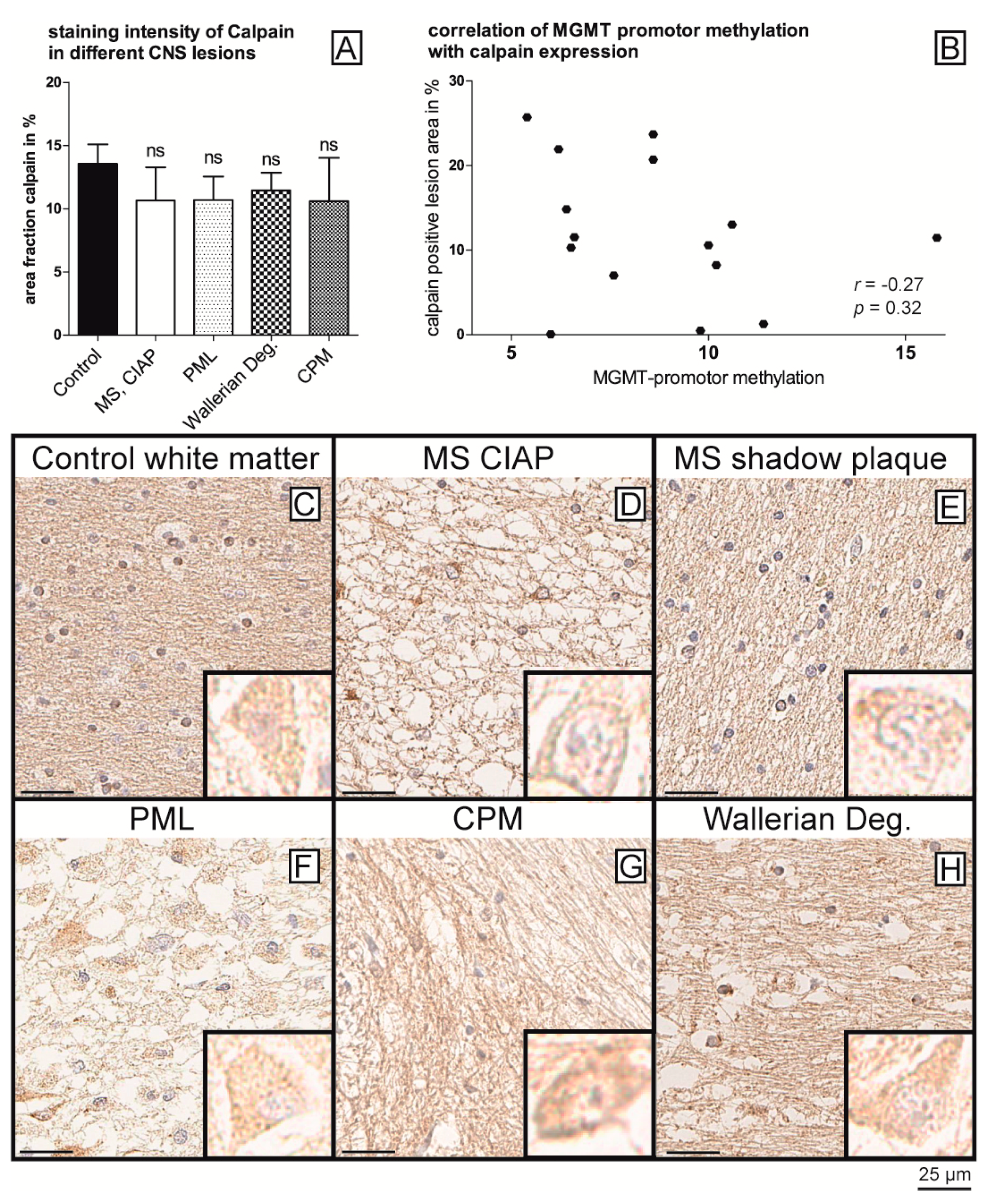 Ijms 22 03845 g004 Ijms 22 03845 g004