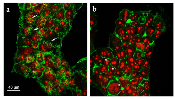 Ijms 22 03871 g004 Ijms 22 03871 g004