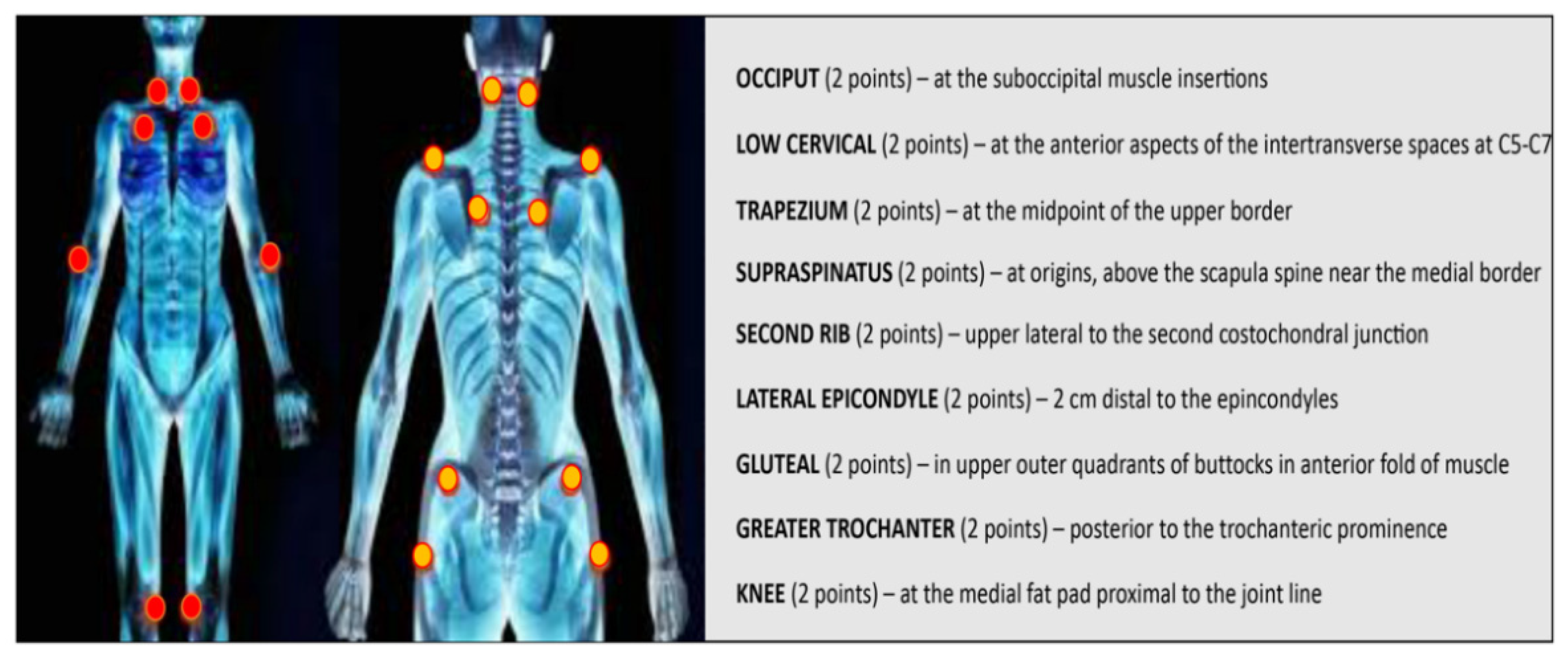 Exercise With Fibromyalgia and Osteoarthritis