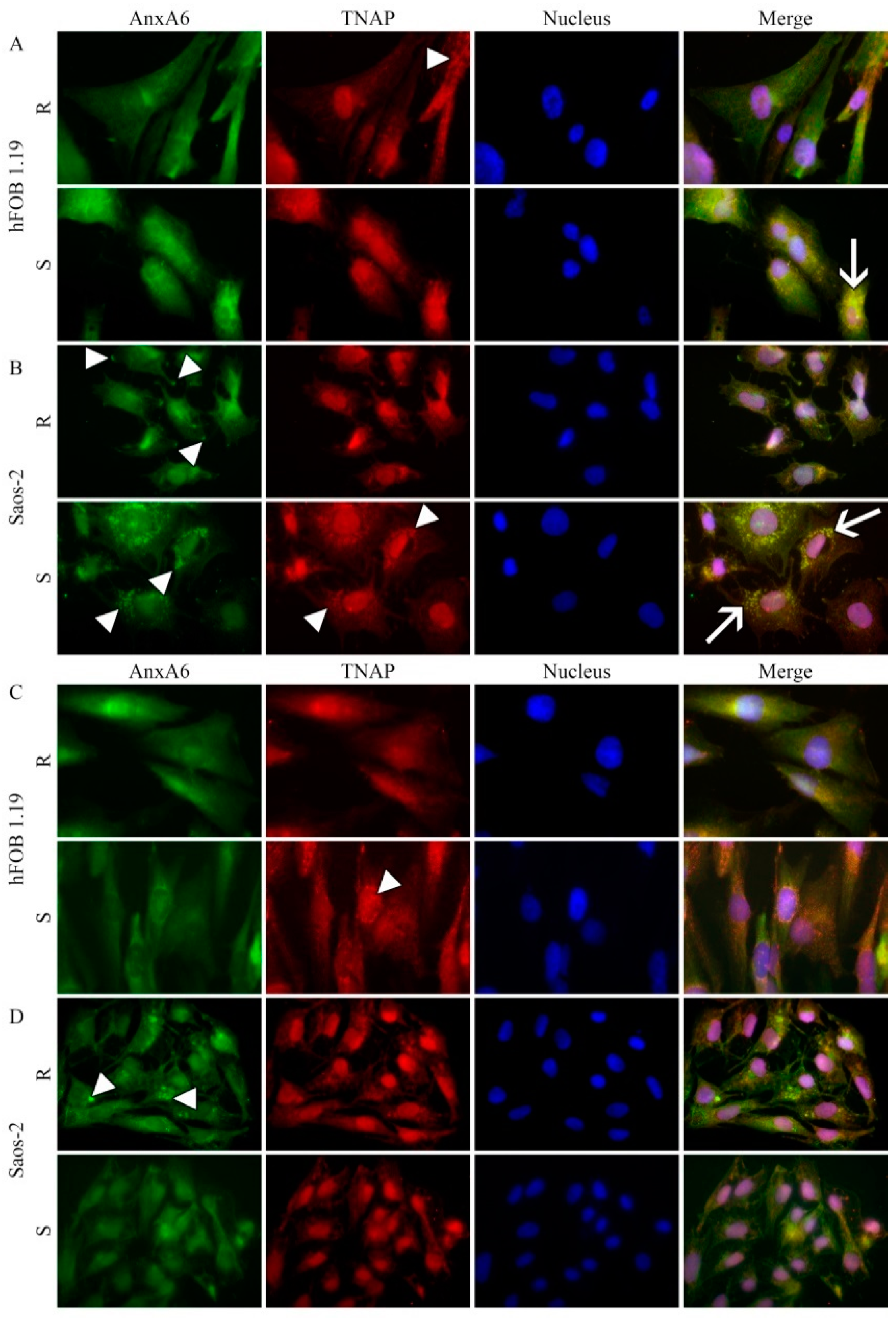 Ijms 22 03993 g005 Ijms 22 03993 g005