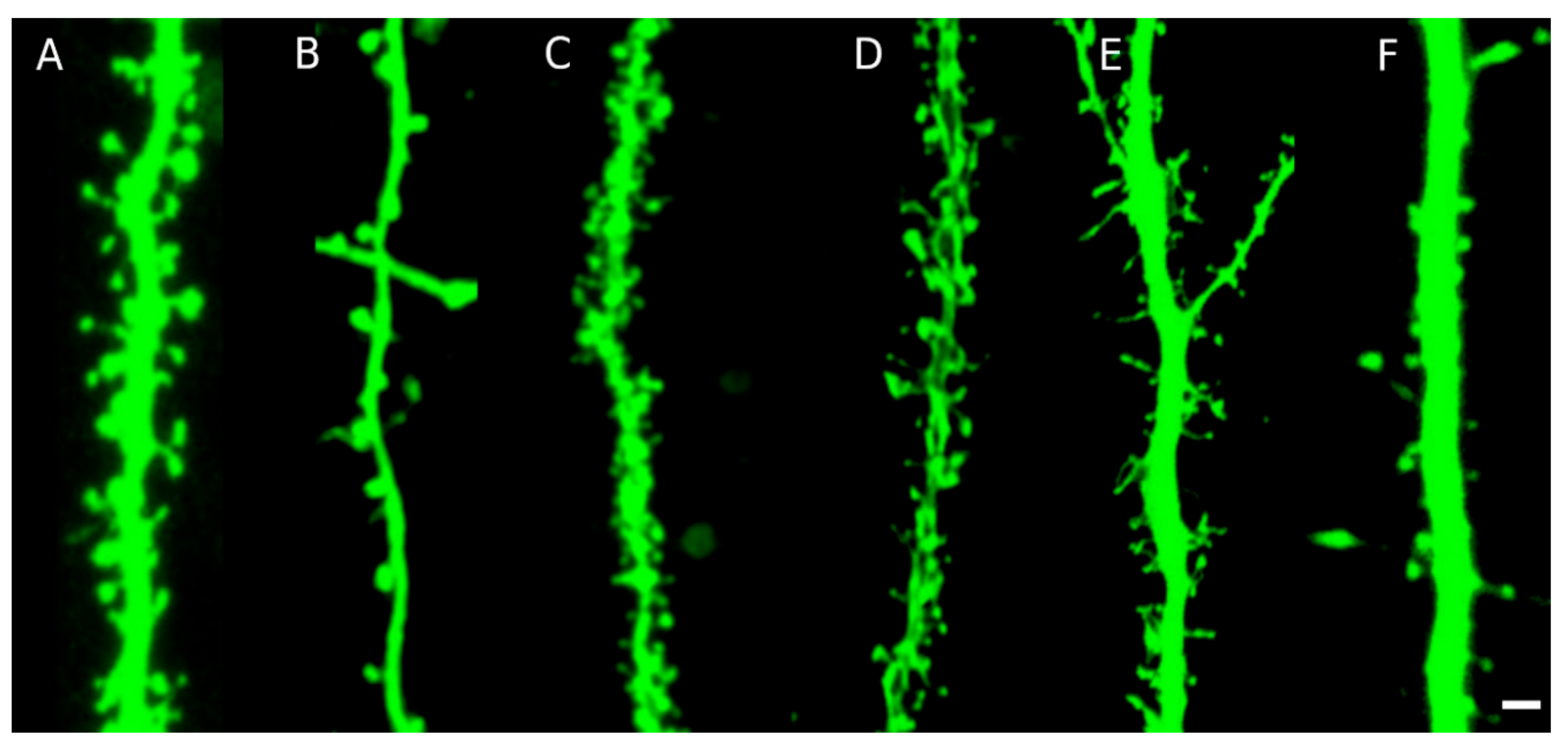 dendrite labeled