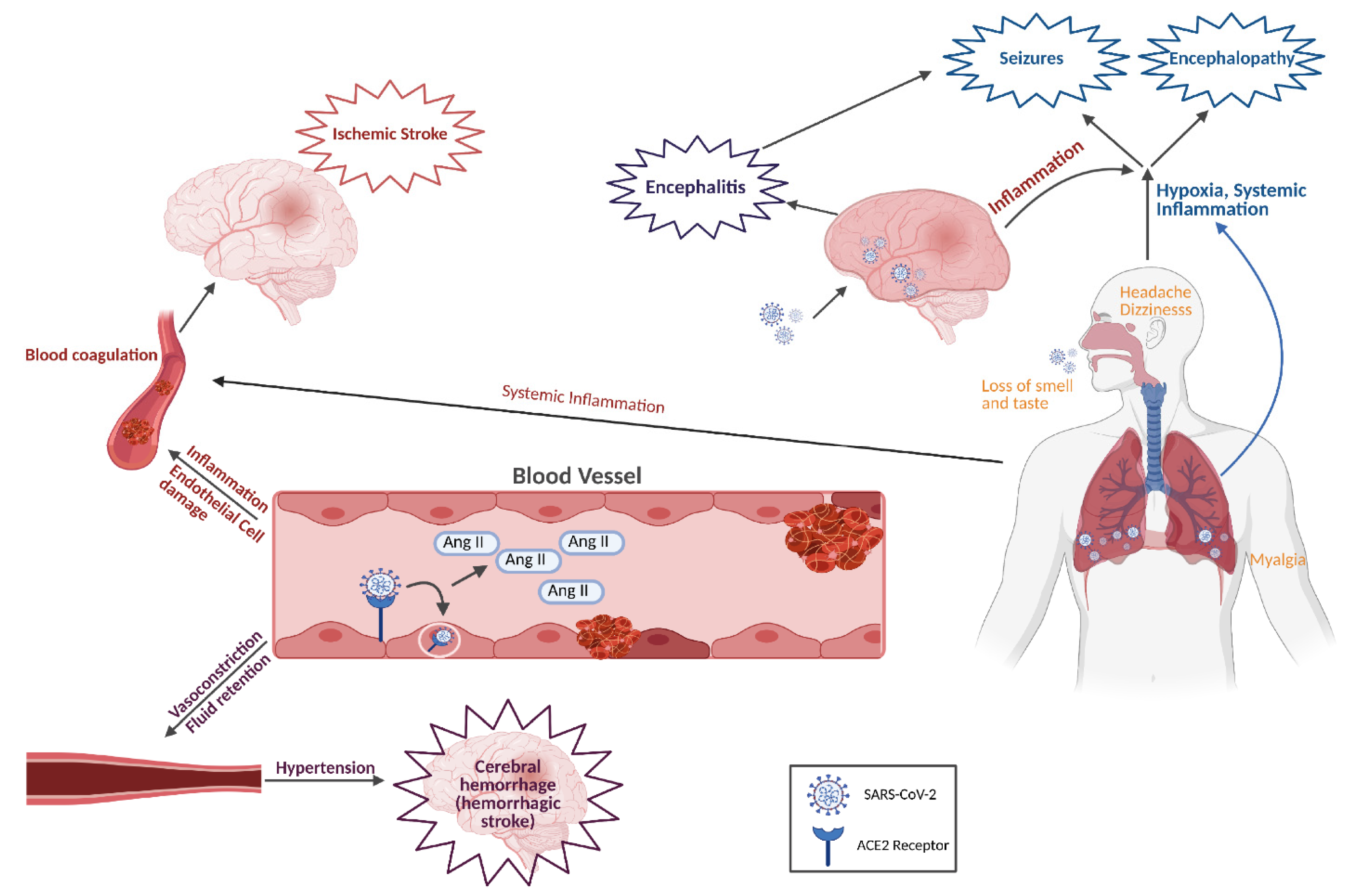 neuromuscular complications of covid 19 a review of the literature