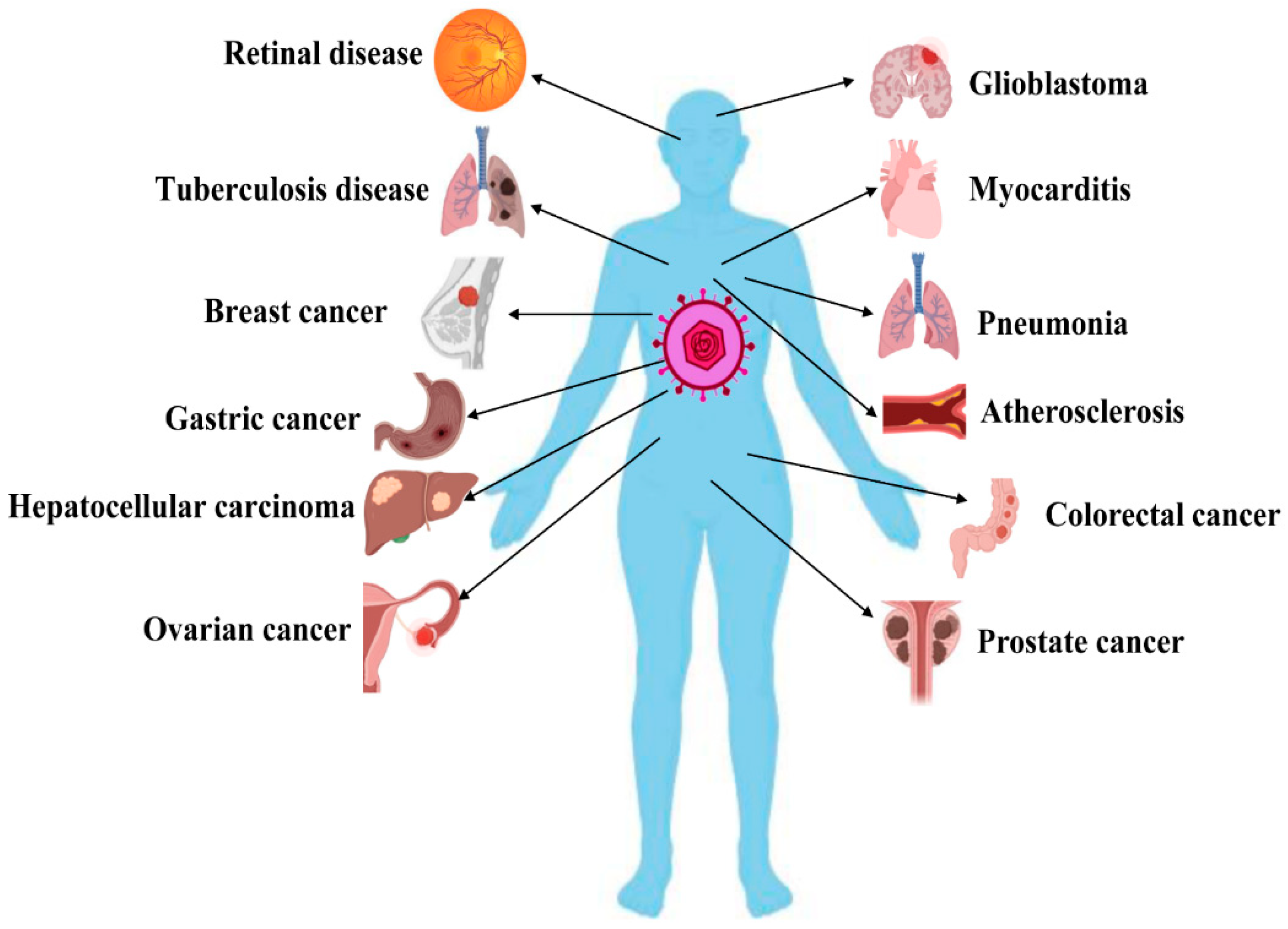 prostatitis cure reddit