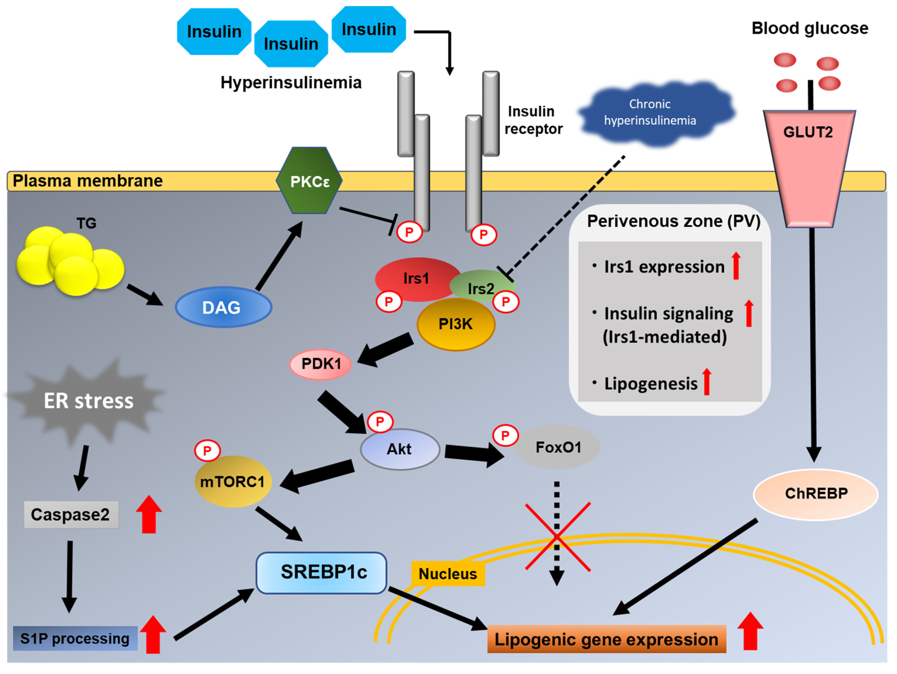 Role of Insulin Resistance in MAFLD Role of Insulin Resistance in MAFLD
