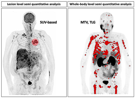 健康・医学 PET in Clinical Oncology Frontiers | The value of combined PET/MRI, CT and clinical