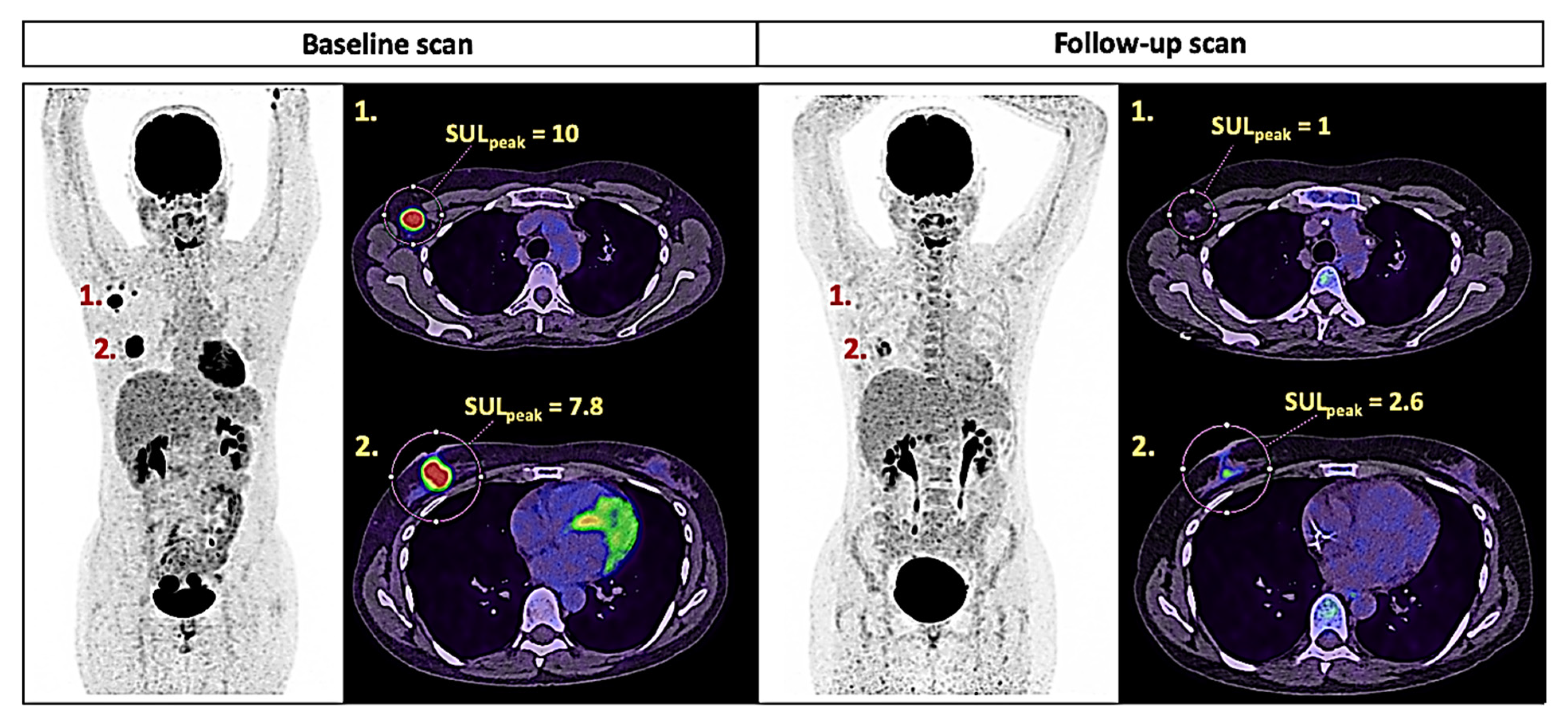 健康・医学 PET in Clinical Oncology PET Imaging in Clinical Oncology | SpringerLink