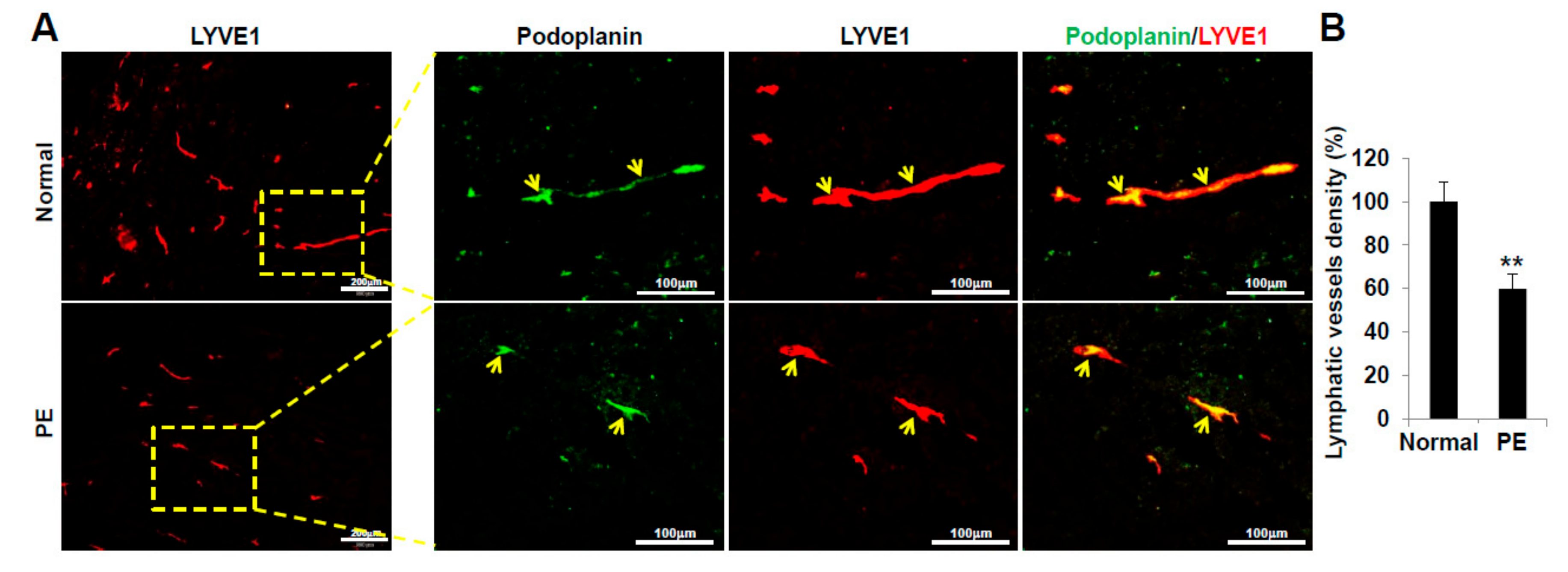 Ijms 22 04237 g007 Ijms 22 04237 g007