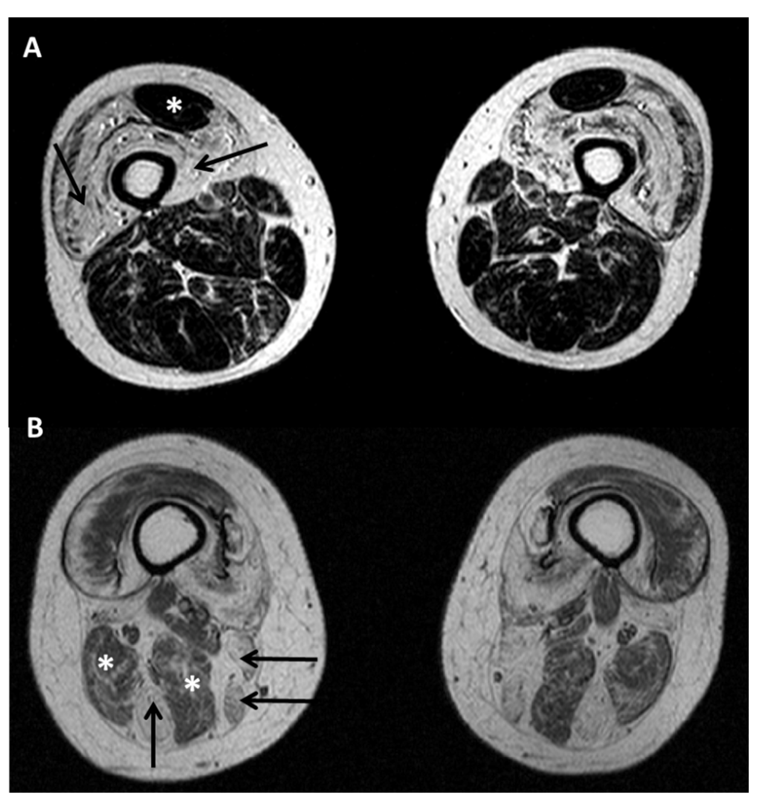 Ijms 22 04256 g004 Ijms 22 04256 g004