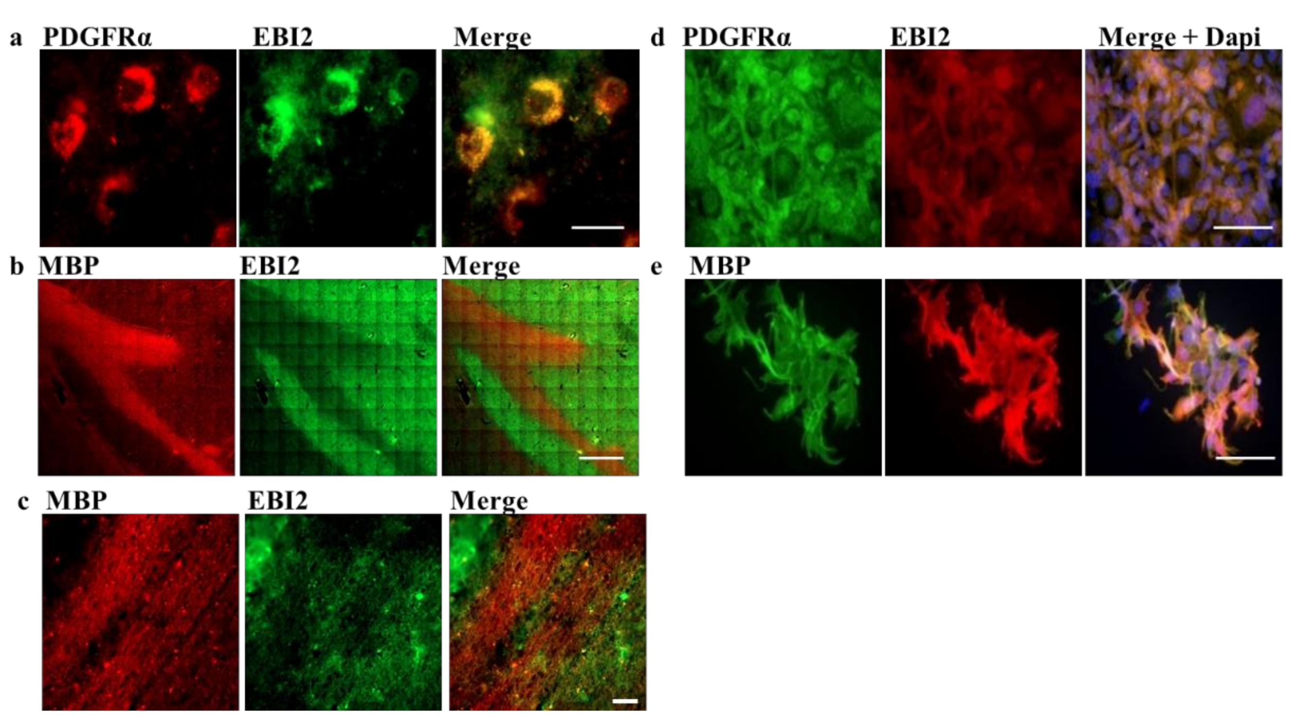 EBI2 Is Temporarily Upregulated in MO3.13 Oligodendrocytes EBI2 Is Temporarily Upregulated in MO3.13 Oligodendrocytes
