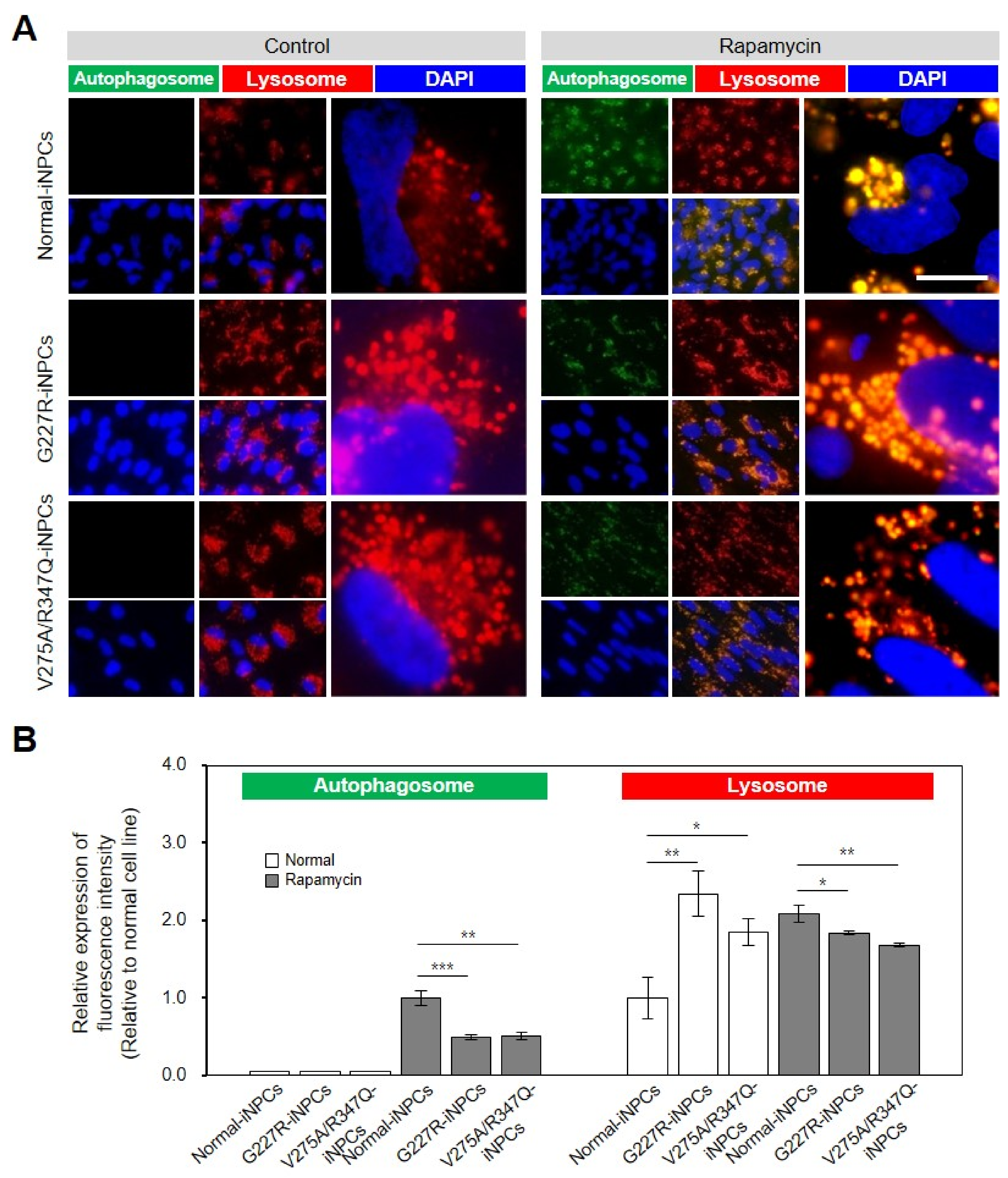 Presynaptic Dysfunction in Neurons Derived from Tay–Sachs iPSCs