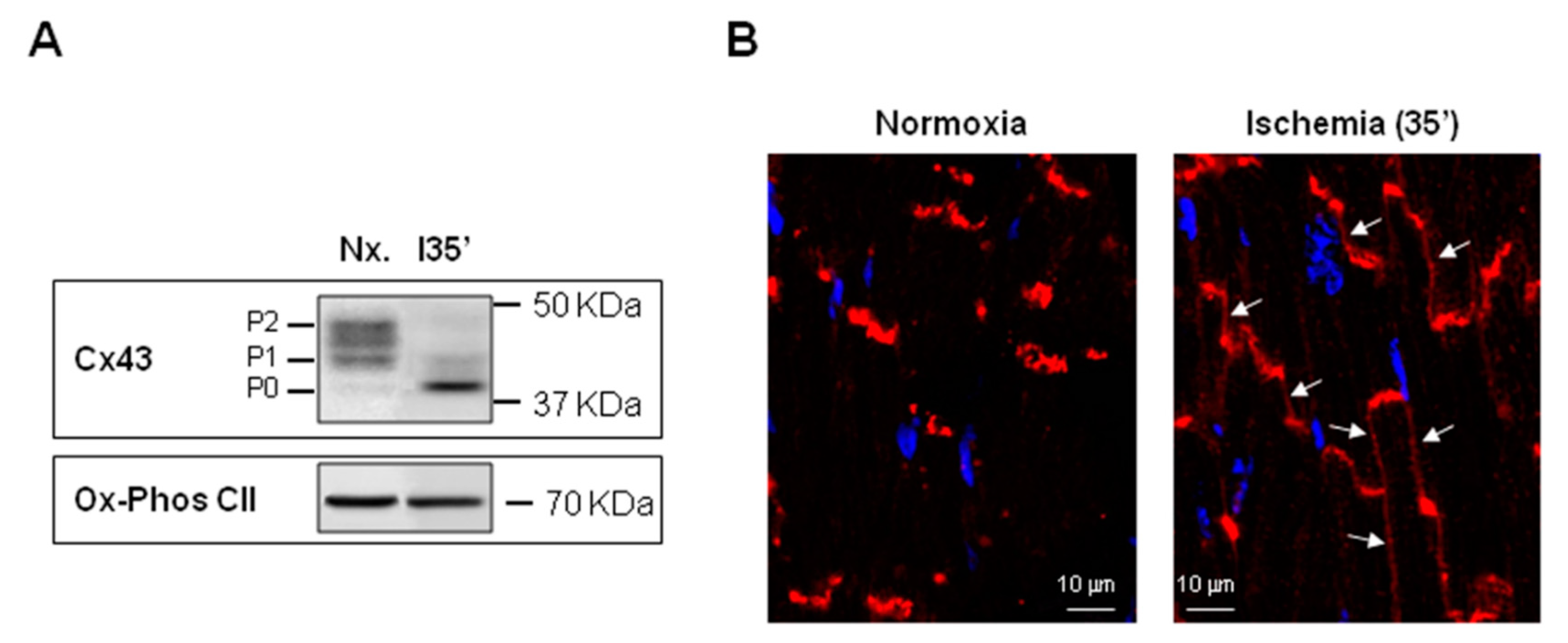 Ijms Free Full Text Connexins In The Heart Regulation Function And Involvement In Cardiac Disease Html Ijms Free Full Text Connexins In The Heart Regulation Function And Involvement In Cardiac Disease Html