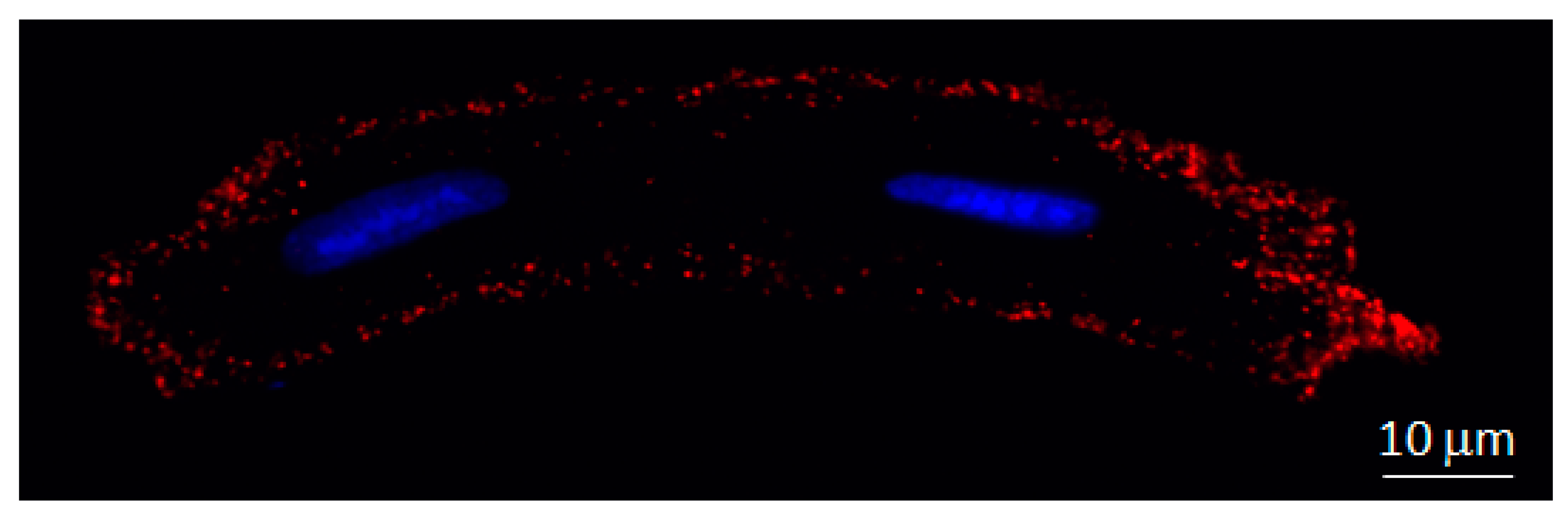 Ijms Free Full Text Connexins In The Heart Regulation Function And Involvement In Cardiac Disease Html Ijms Free Full Text Connexins In The Heart Regulation Function And Involvement In Cardiac Disease Html