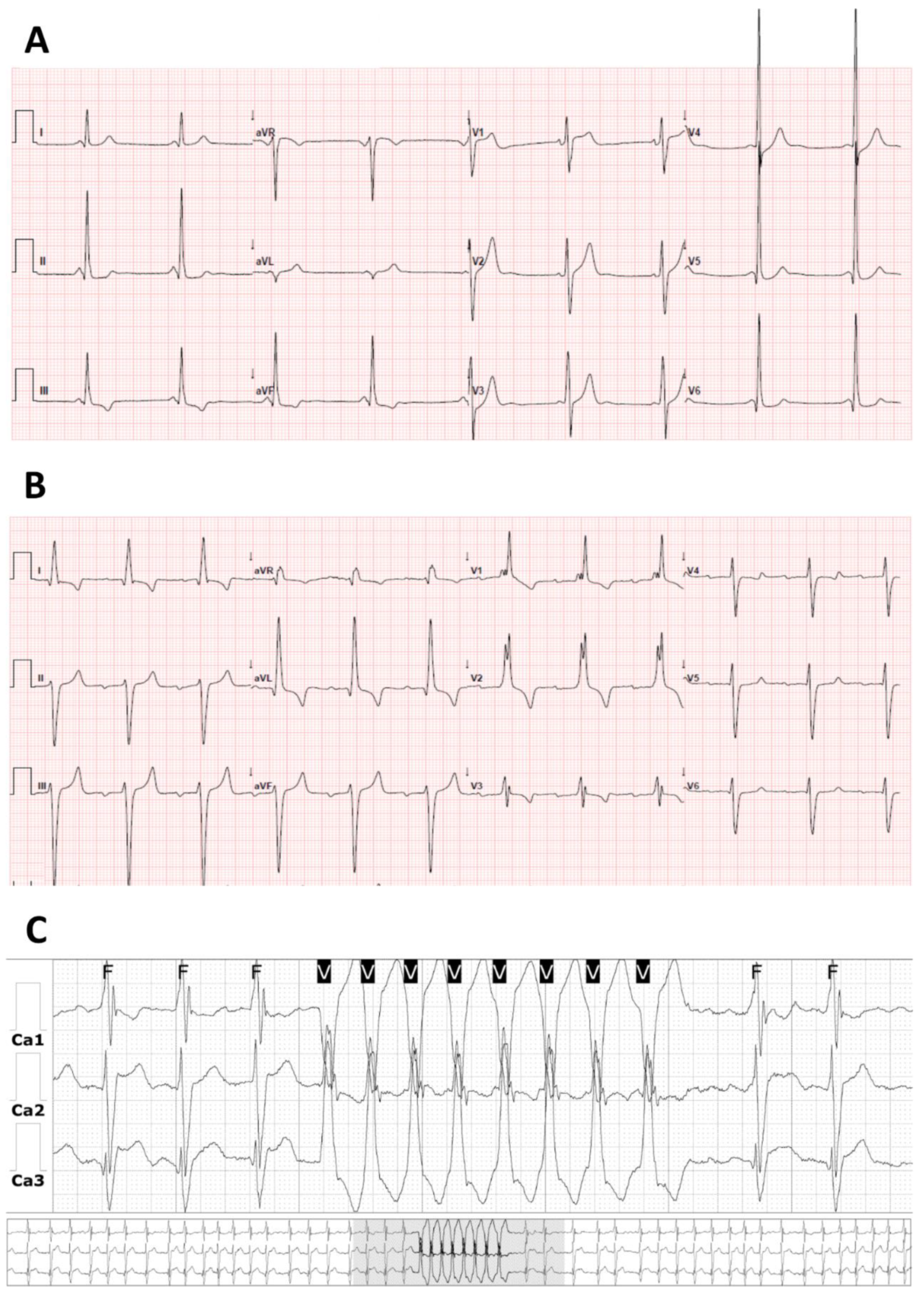 Ijms 22 04434 g006 Ijms 22 04434 g006