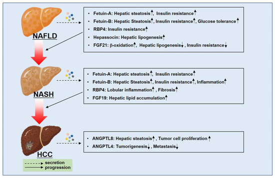 Metabolic Spectrum of Liver Failure in Type 2 Diabetes and