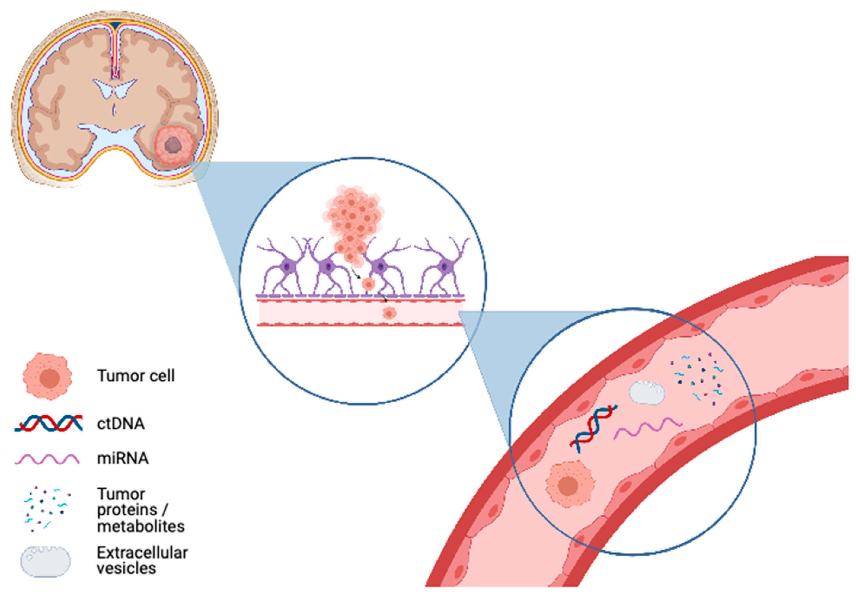 Ijms Free Full Text Liquid Biomarkers For Improved Diagnosis And Classification Of Cns Tumors Html