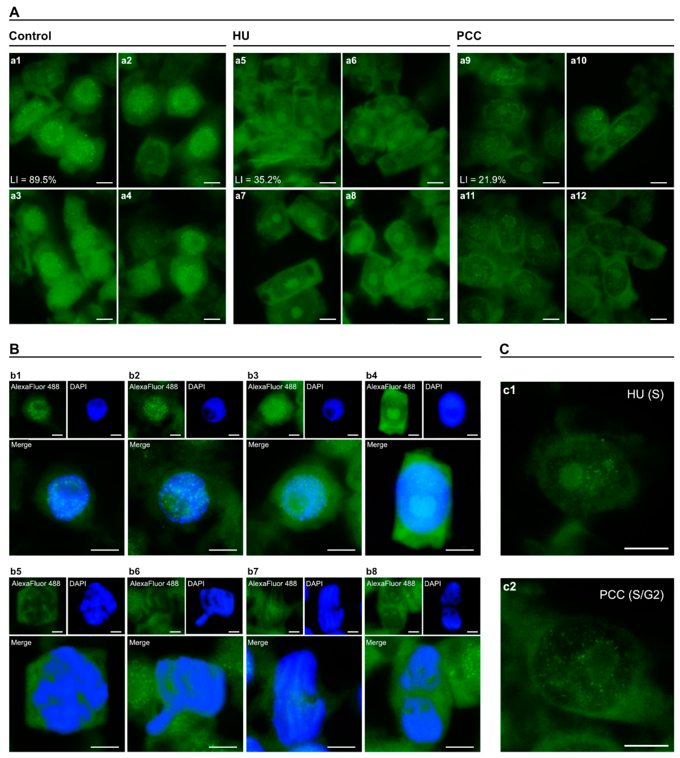 Ijms Free Full Text Hydroxyurea And Caffeine Impact Prb Like Protein Dependent Chromatin Architecture Profiles In Interphase Cells Of Vicia Faba Html
