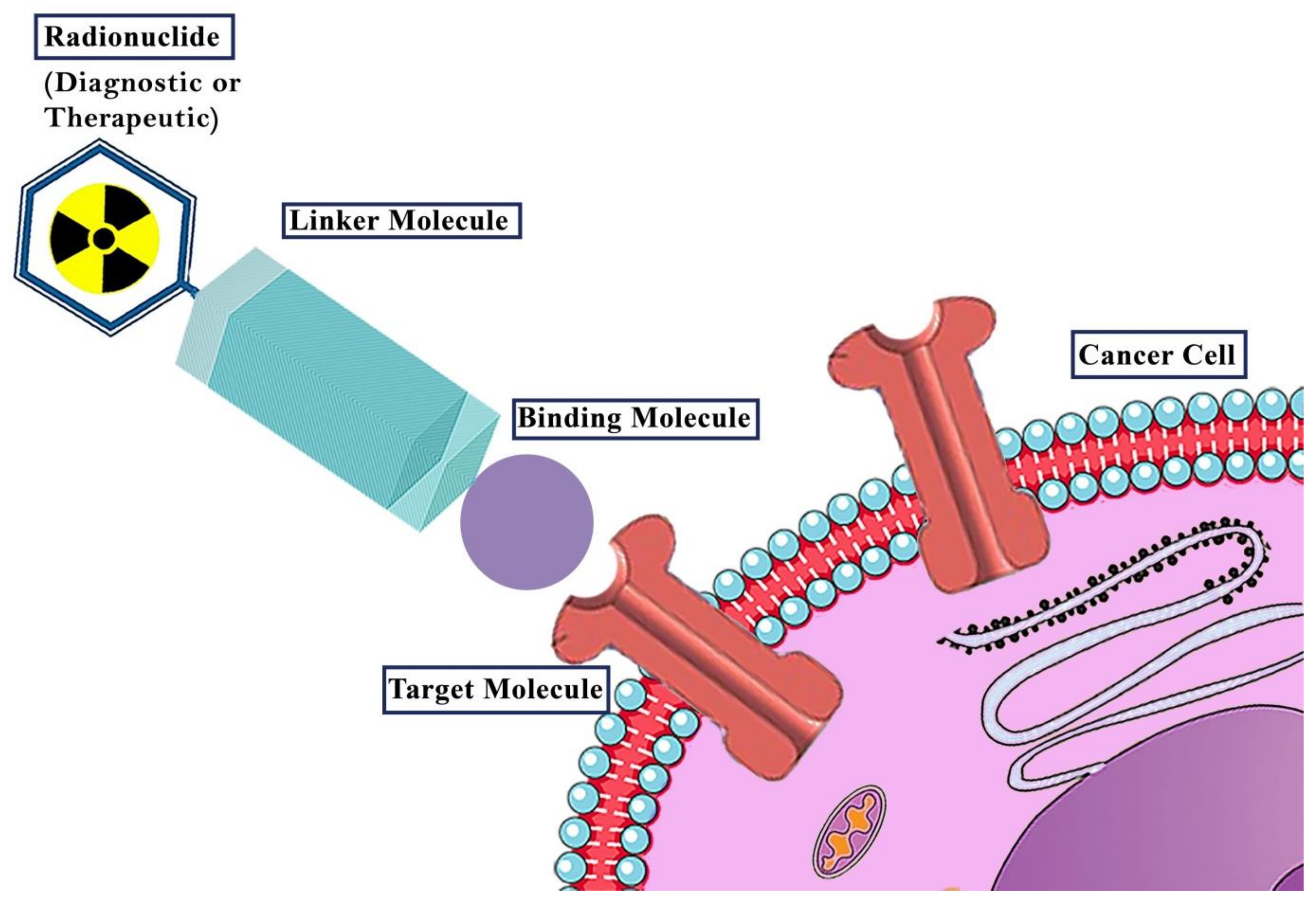 健康・医学 Preneoplasia of the Breast Theranostic Advances in Breast Cancer in Nuclear Medicine