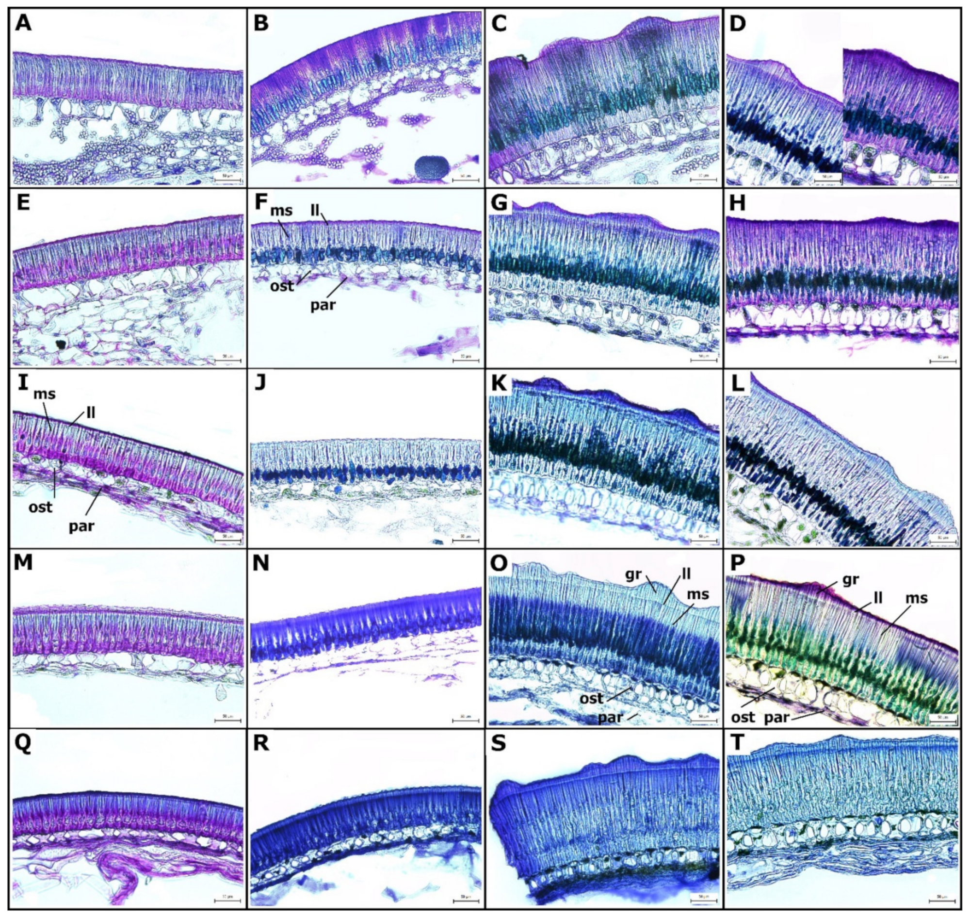 Ijms Free Full Text Anatomy And Histochemistry Of Seed Coat Development Of Wild Pisum Sativum Subsp Elatius M Bieb Asch Et Graebn And Domesticated Pea Pisum Sativum Subsp Sativum L Html