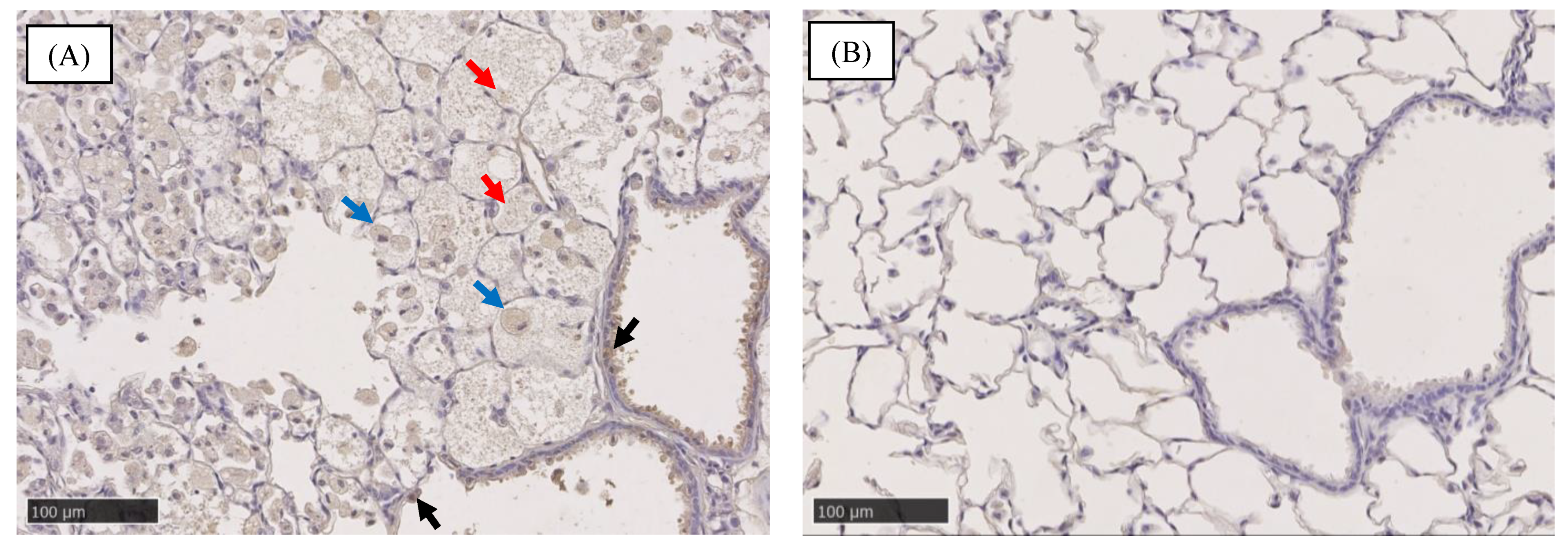 Ijms 22 04635 g005 Ijms 22 04635 g005