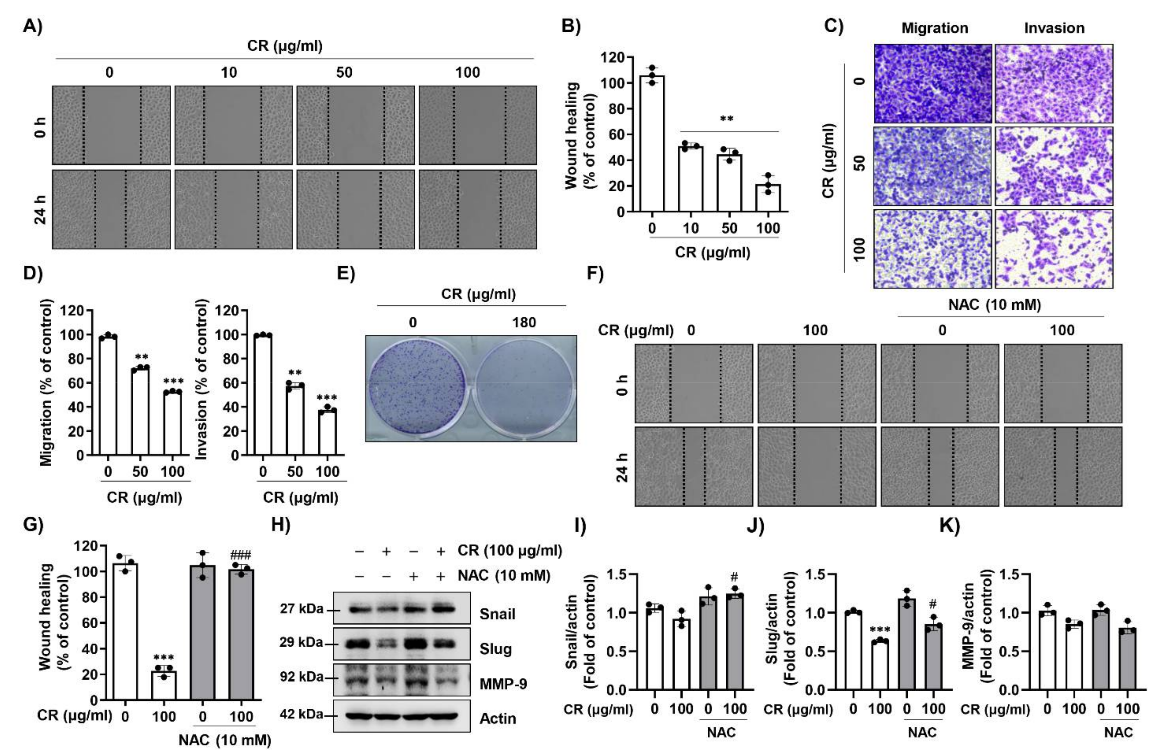 Ijms 22 04797 g004 Ijms 22 04797 g004