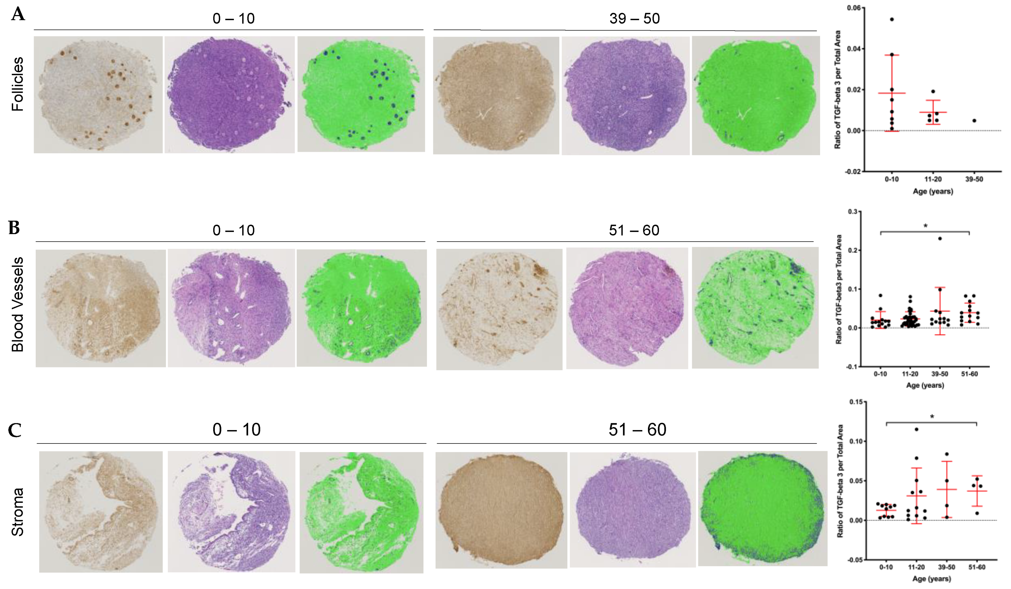 anti aging 3 tma