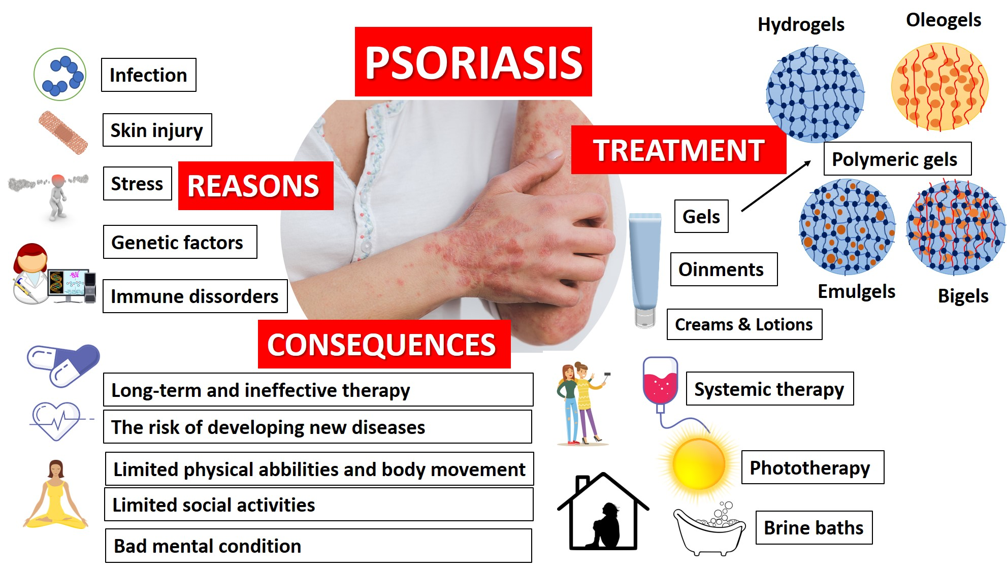 psoriasis vulgaris treatment