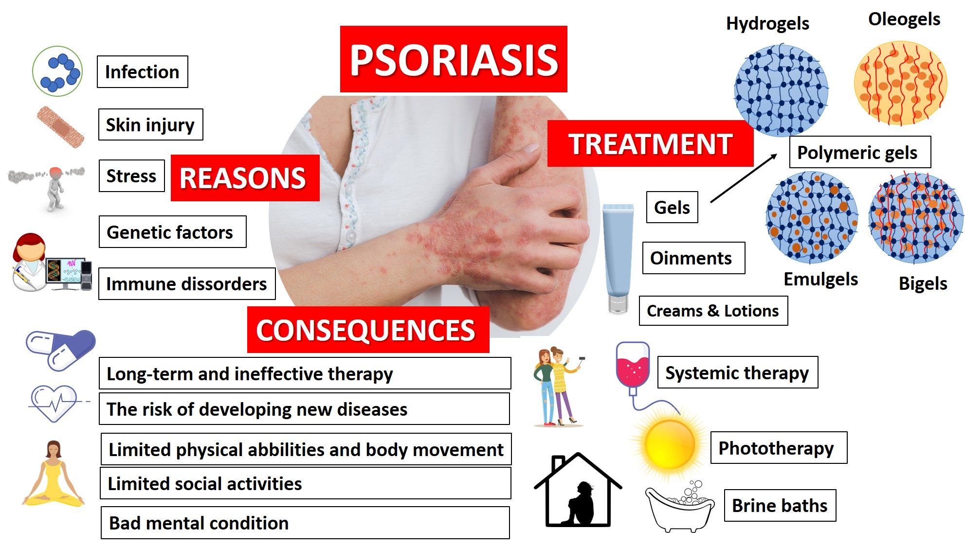 New Psoriasis Treatment 2023 Injection