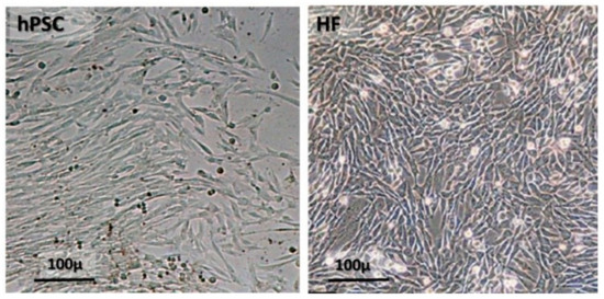 Allogenic Use of Human Placenta-Derived Stromal Cells as a